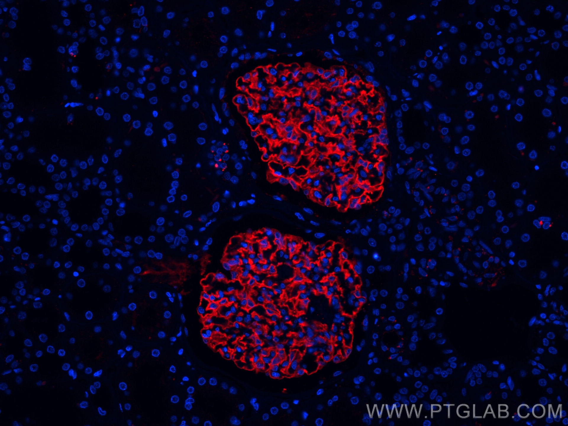 Immunofluorescence (IF) / fluorescent staining of human kidney tissue using CoraLite®594-conjugated Podocalyxin Polyclonal ant (CL594-18150)