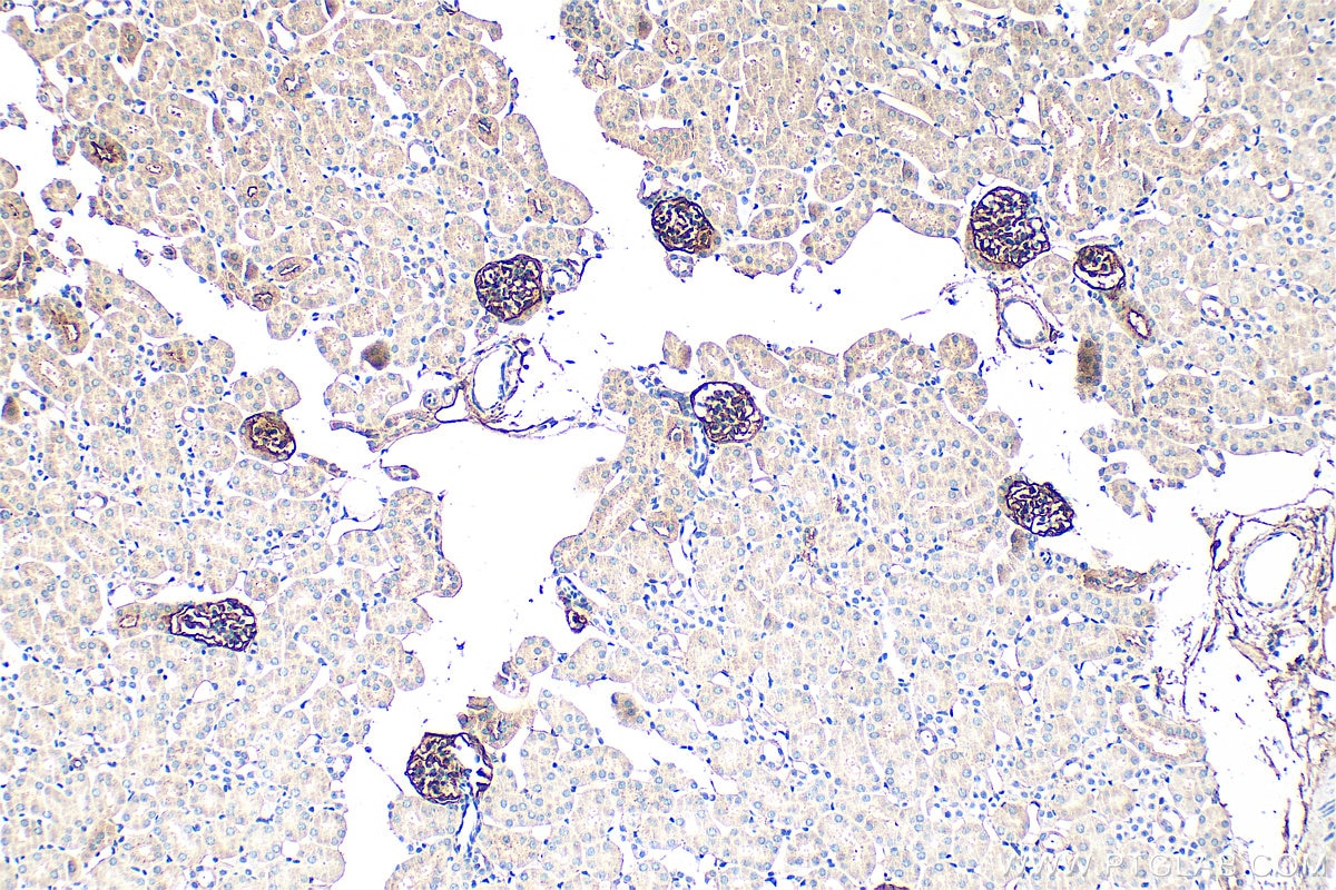 Immunohistochemistry (IHC) staining of mouse kidney tissue using Podoplanin Polyclonal antibody (33099-1-AP)