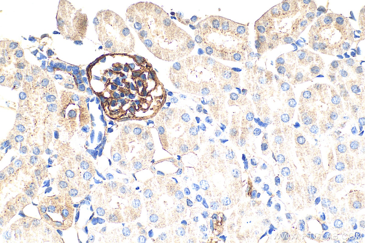 Immunohistochemistry (IHC) staining of mouse kidney tissue using Podoplanin Polyclonal antibody (33099-1-AP)
