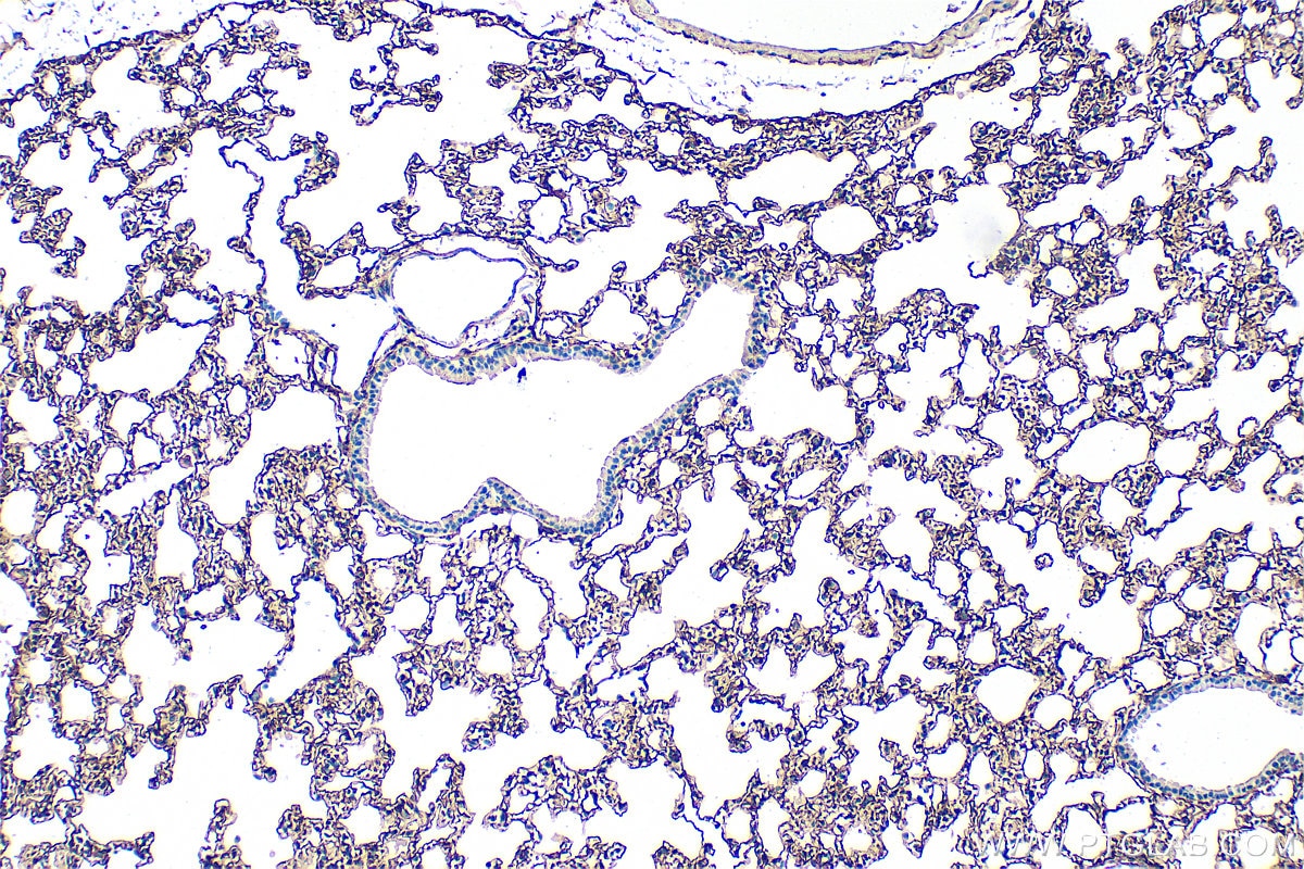 Immunohistochemistry (IHC) staining of mouse lung tissue using Podoplanin Polyclonal antibody (33099-1-AP)