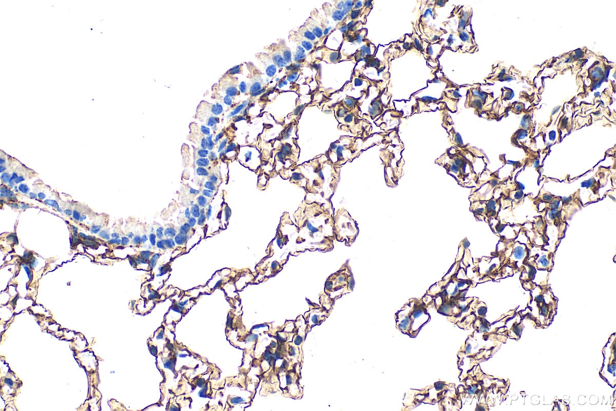 Immunohistochemistry (IHC) staining of mouse lung tissue using Podoplanin Polyclonal antibody (33099-1-AP)