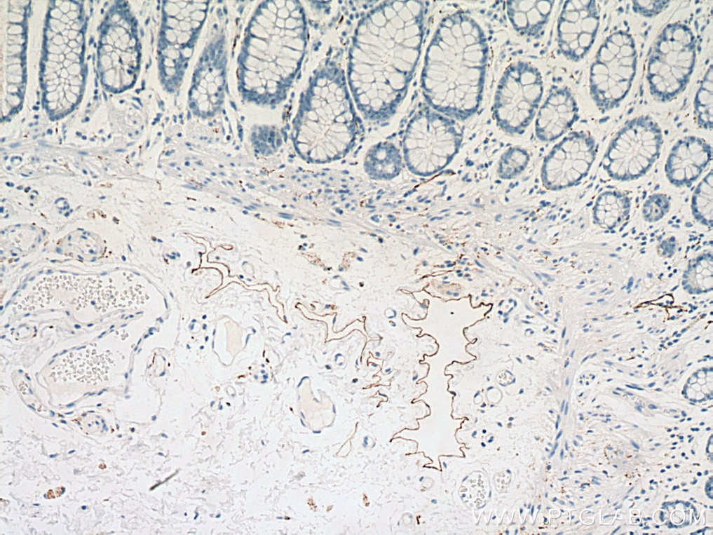 Immunohistochemistry (IHC) staining of human colon tissue using Podoplanin Monoclonal antibody (67432-1-Ig)