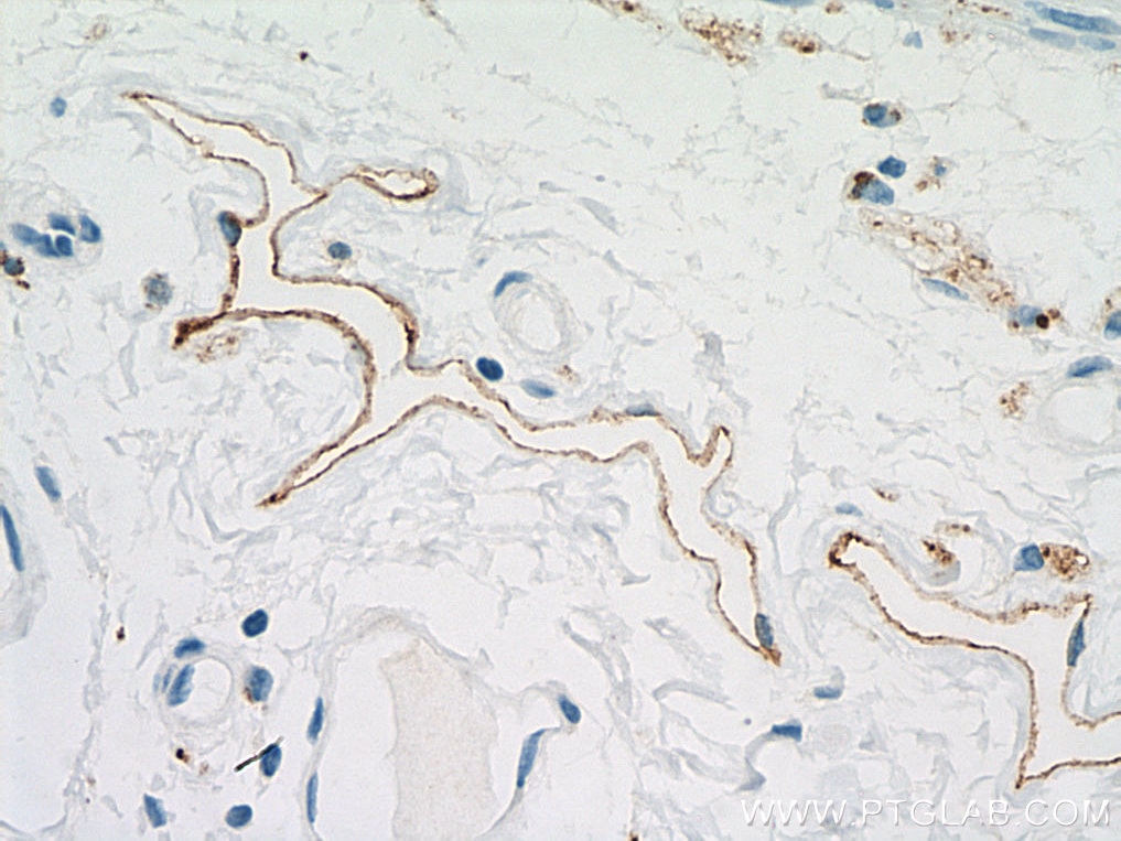 Immunohistochemistry (IHC) staining of human colon tissue using Podoplanin Monoclonal antibody (67432-1-Ig)