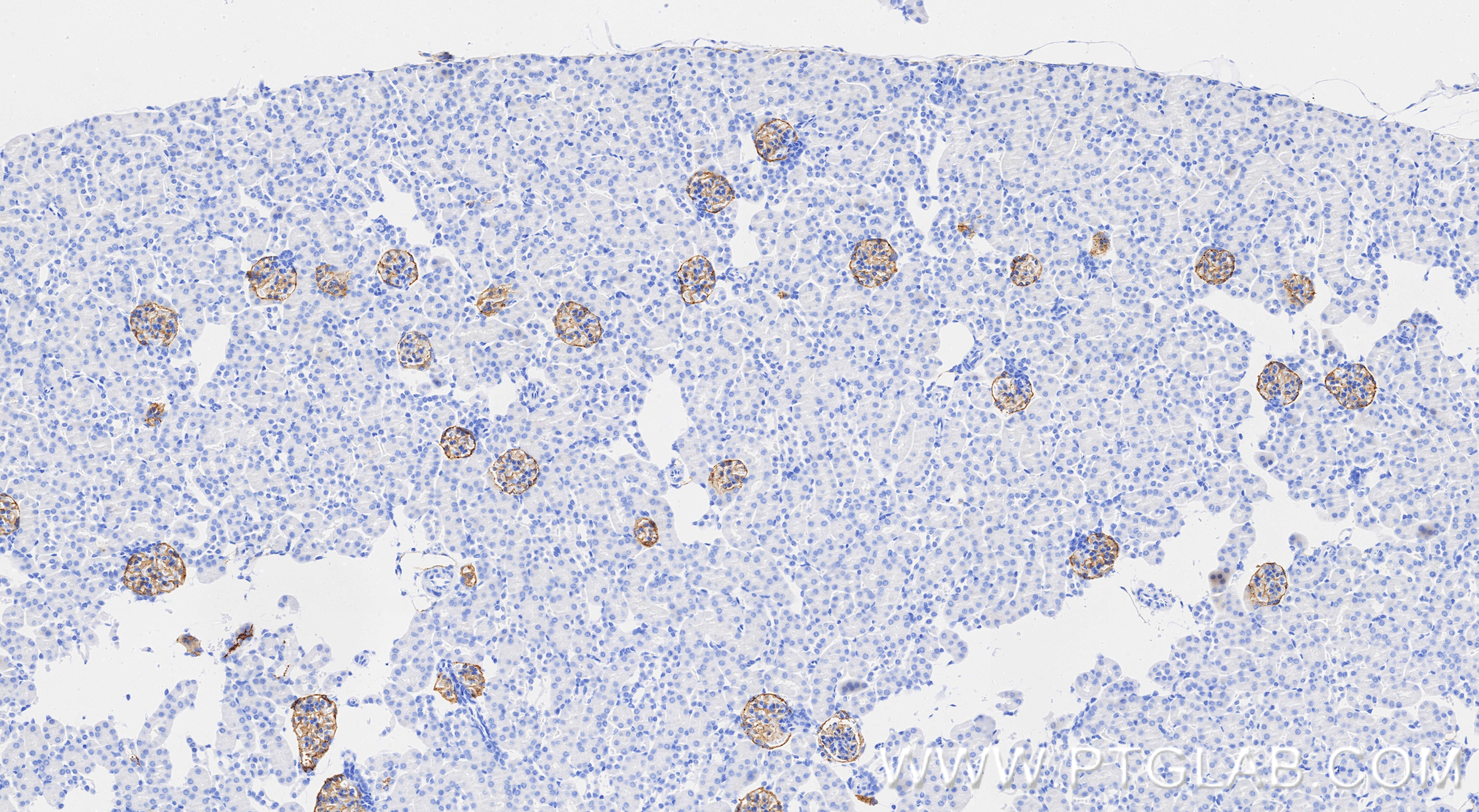 Immunohistochemistry (IHC) staining of mouse kidney tissue using Podoplanin Recombinant monoclonal antibody (86107-1-RR)