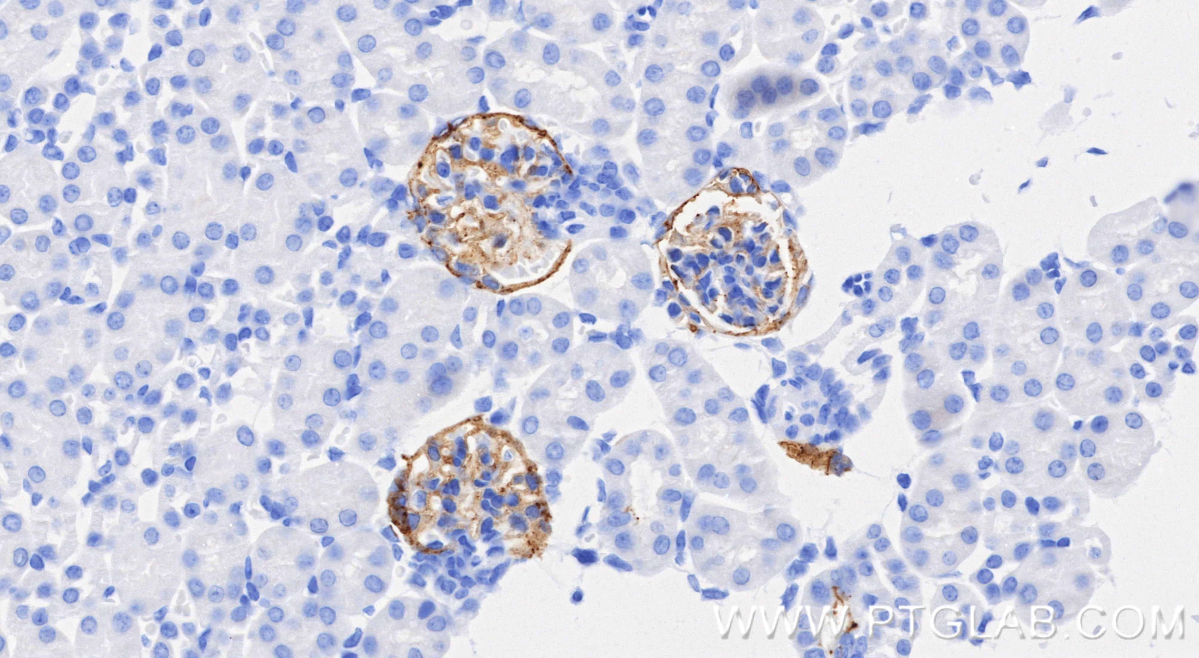 Immunohistochemistry (IHC) staining of mouse kidney tissue using Podoplanin Recombinant monoclonal antibody (86107-1-RR)