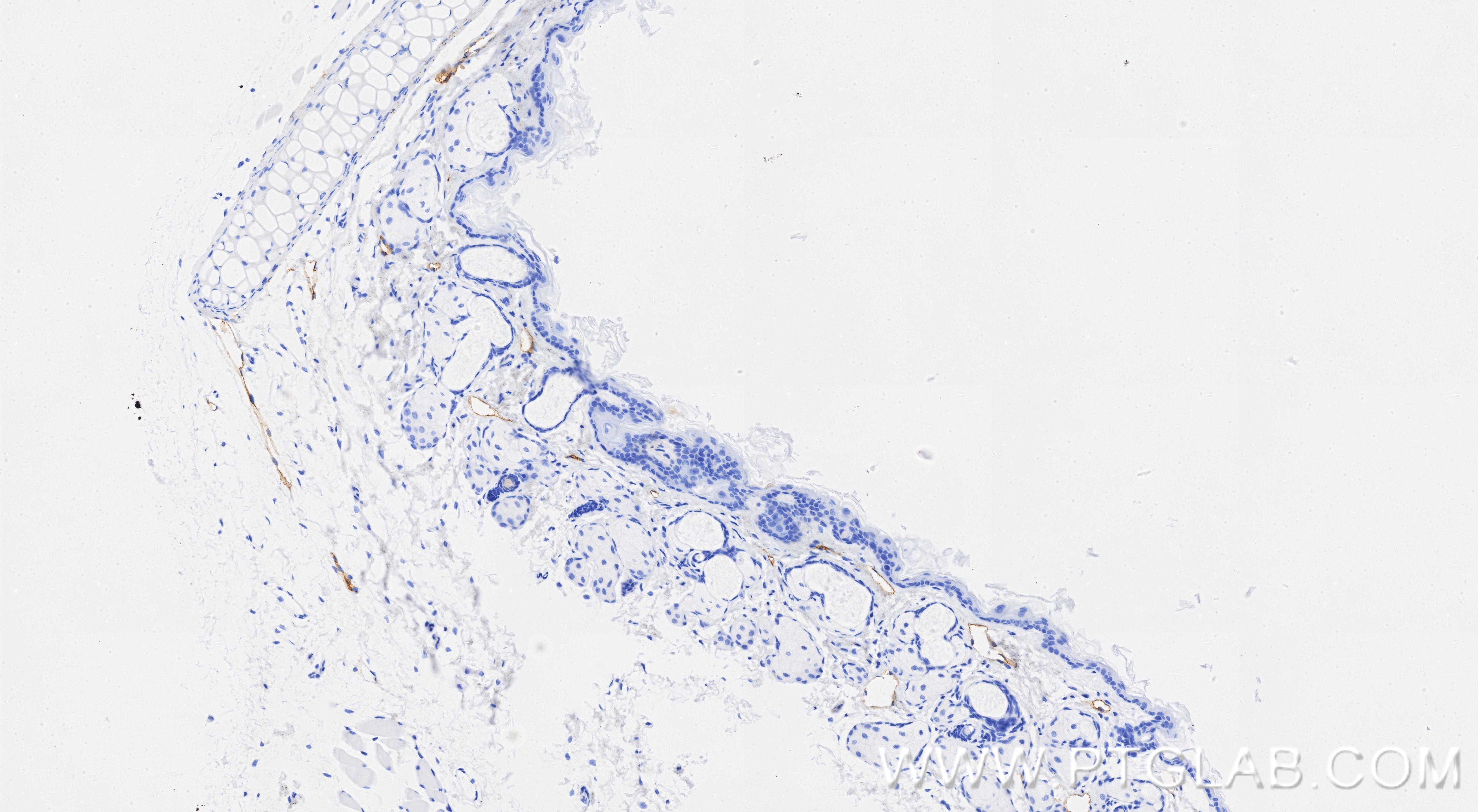 Immunohistochemistry (IHC) staining of mouse skin tissue using Podoplanin Recombinant monoclonal antibody (86107-1-RR)