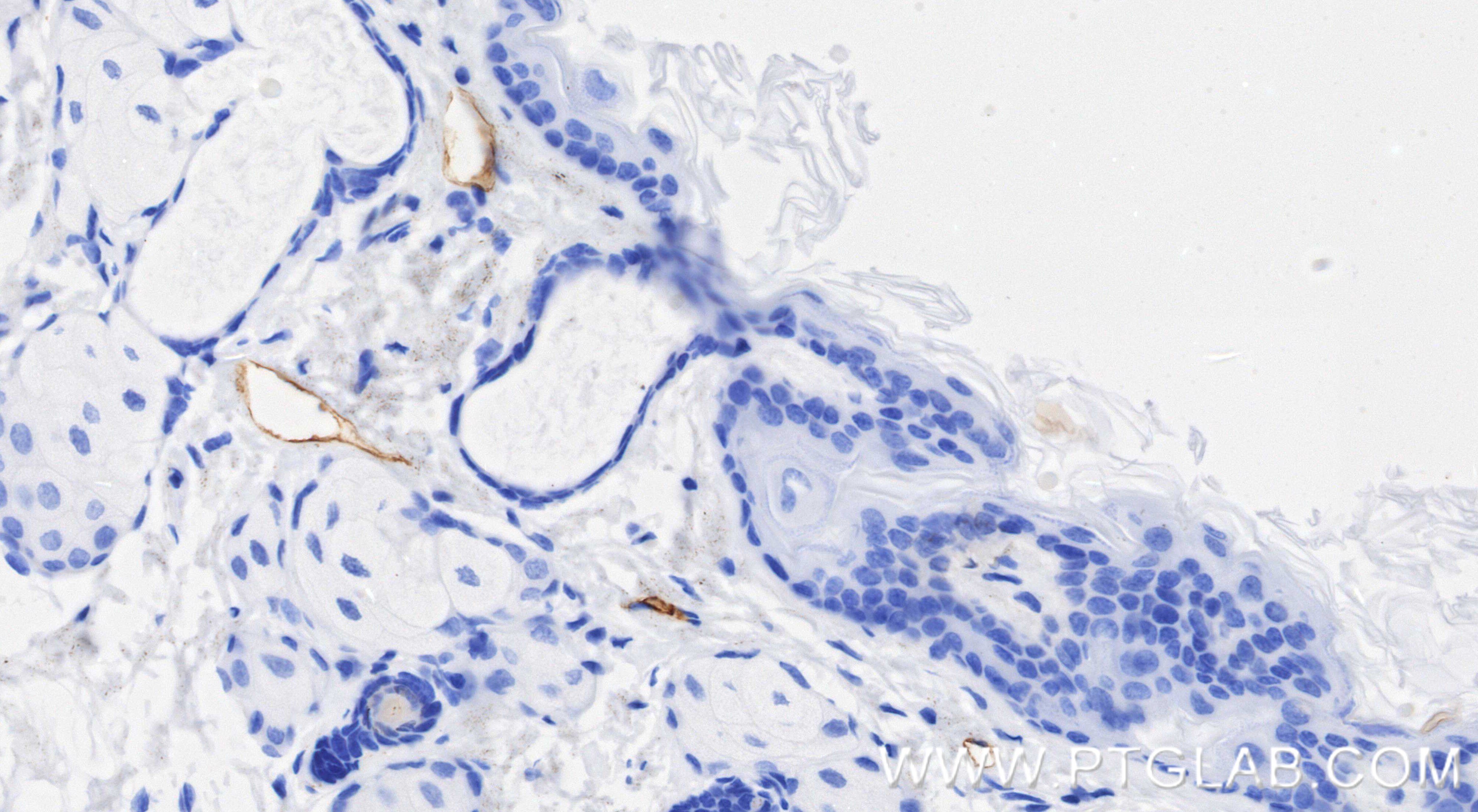 Immunohistochemistry (IHC) staining of mouse skin tissue using Podoplanin Recombinant monoclonal antibody (86107-1-RR)