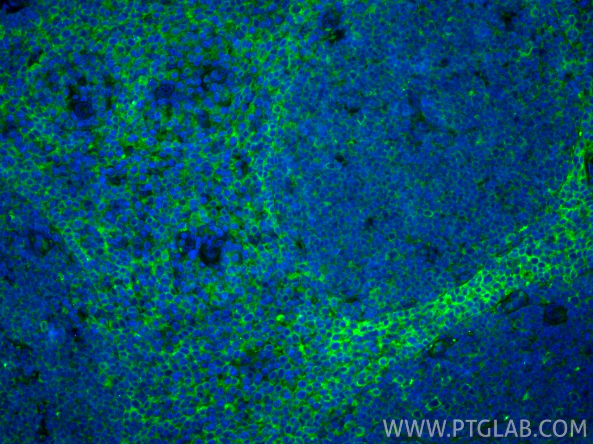 Immunofluorescence (IF) / fluorescent staining of human tonsillitis tissue using Podoplanin Recombinant monoclonal antibody (86750-2-RR)