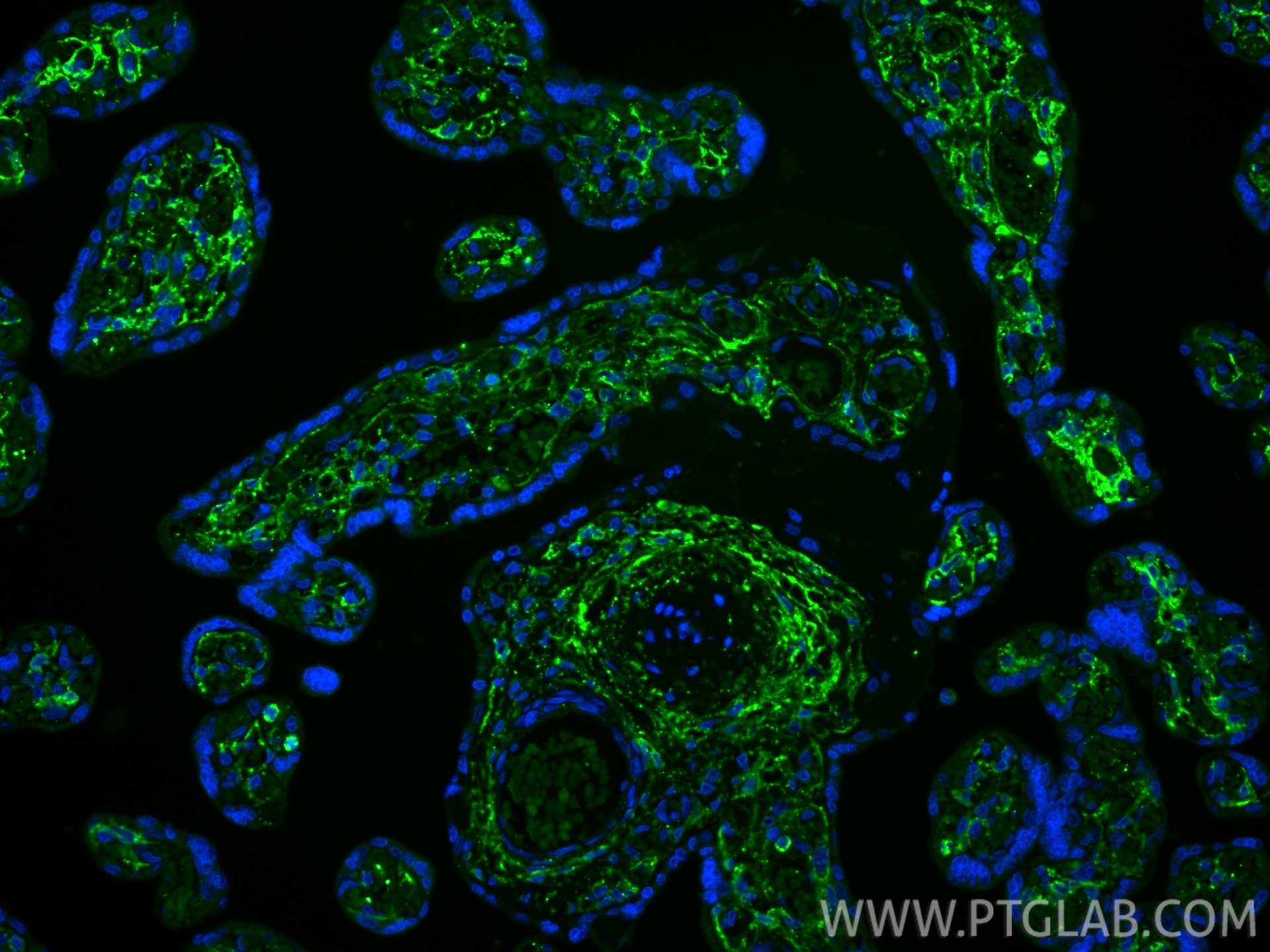 Immunofluorescence (IF) / fluorescent staining of human placenta tissue using Podoplanin Recombinant monoclonal antibody (86750-2-RR)