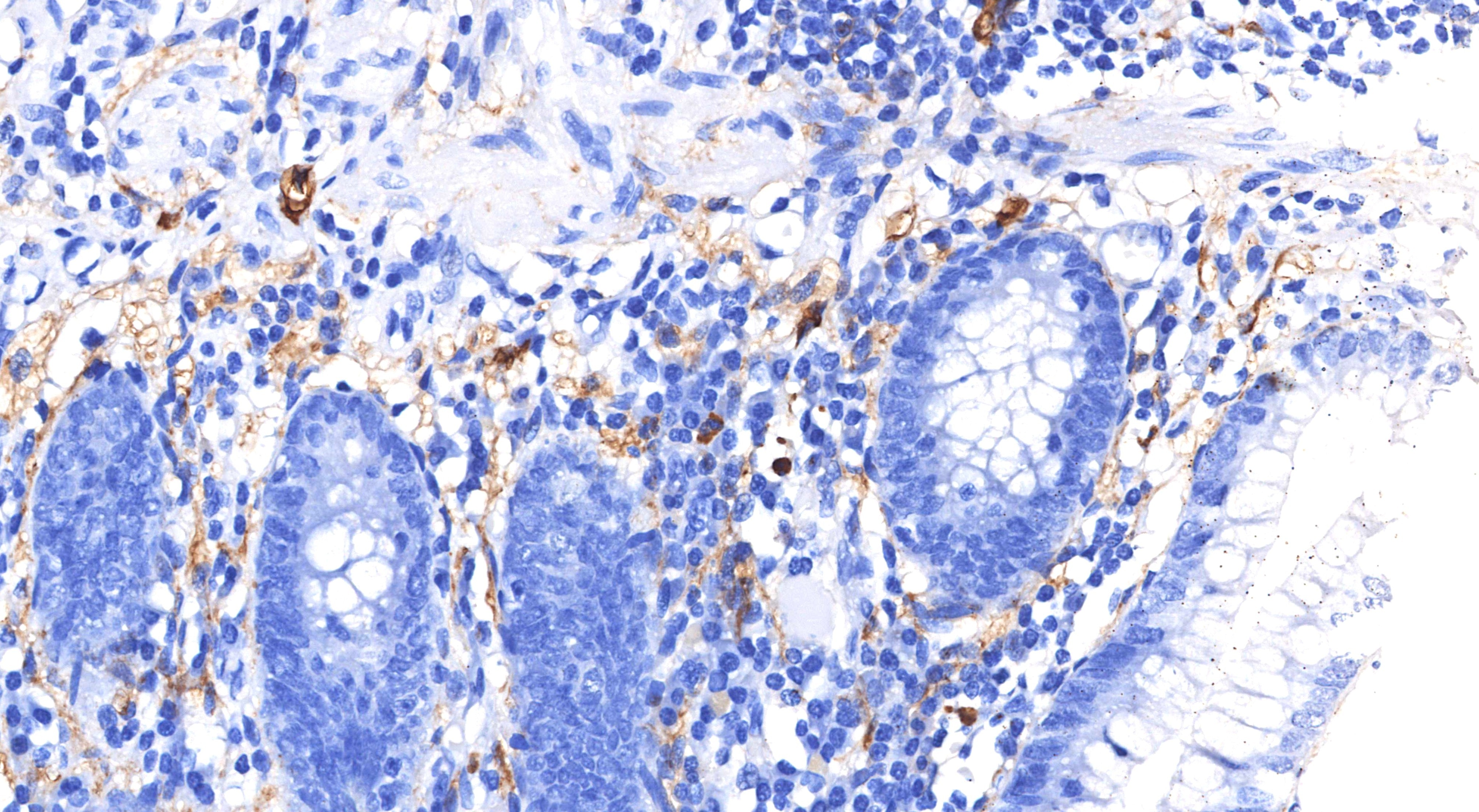 Immunohistochemistry (IHC) staining of human appendix tissue using Podoplanin Recombinant monoclonal antibody (86750-2-RR)