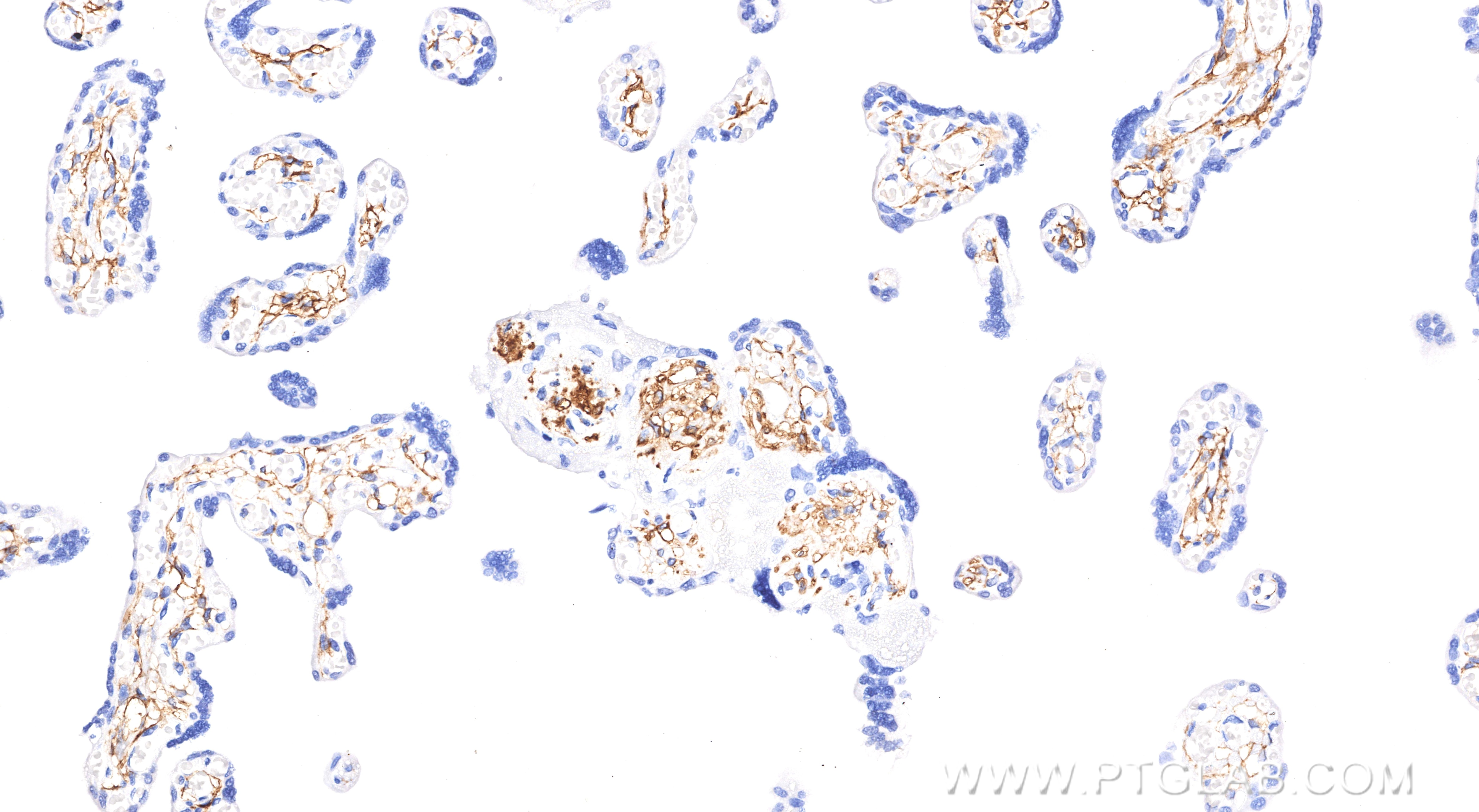 Immunohistochemistry (IHC) staining of human placenta tissue using Podoplanin Recombinant monoclonal antibody (86750-2-RR)