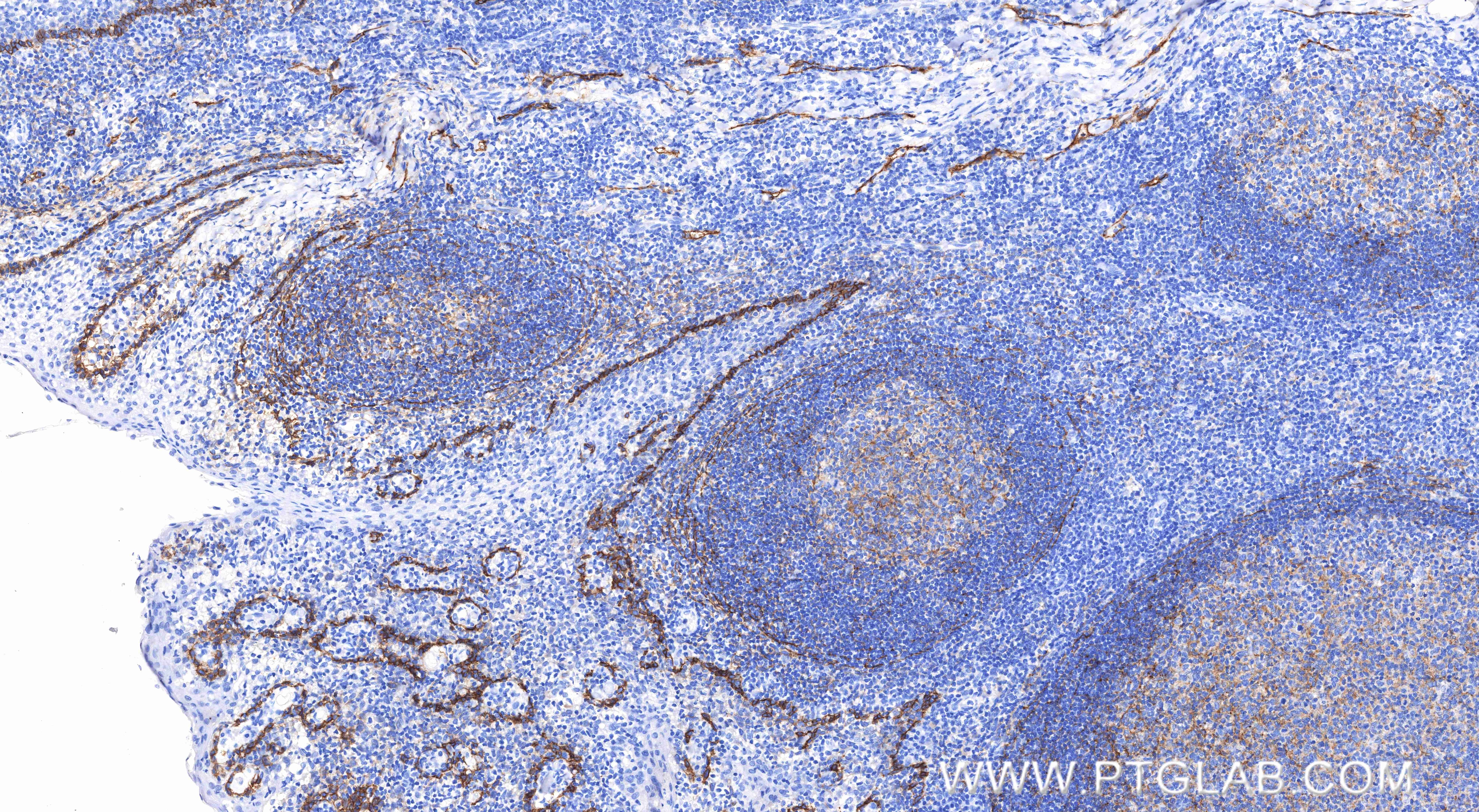 Immunohistochemistry (IHC) staining of human tonsil tissue using Podoplanin Recombinant monoclonal antibody (86750-2-RR)