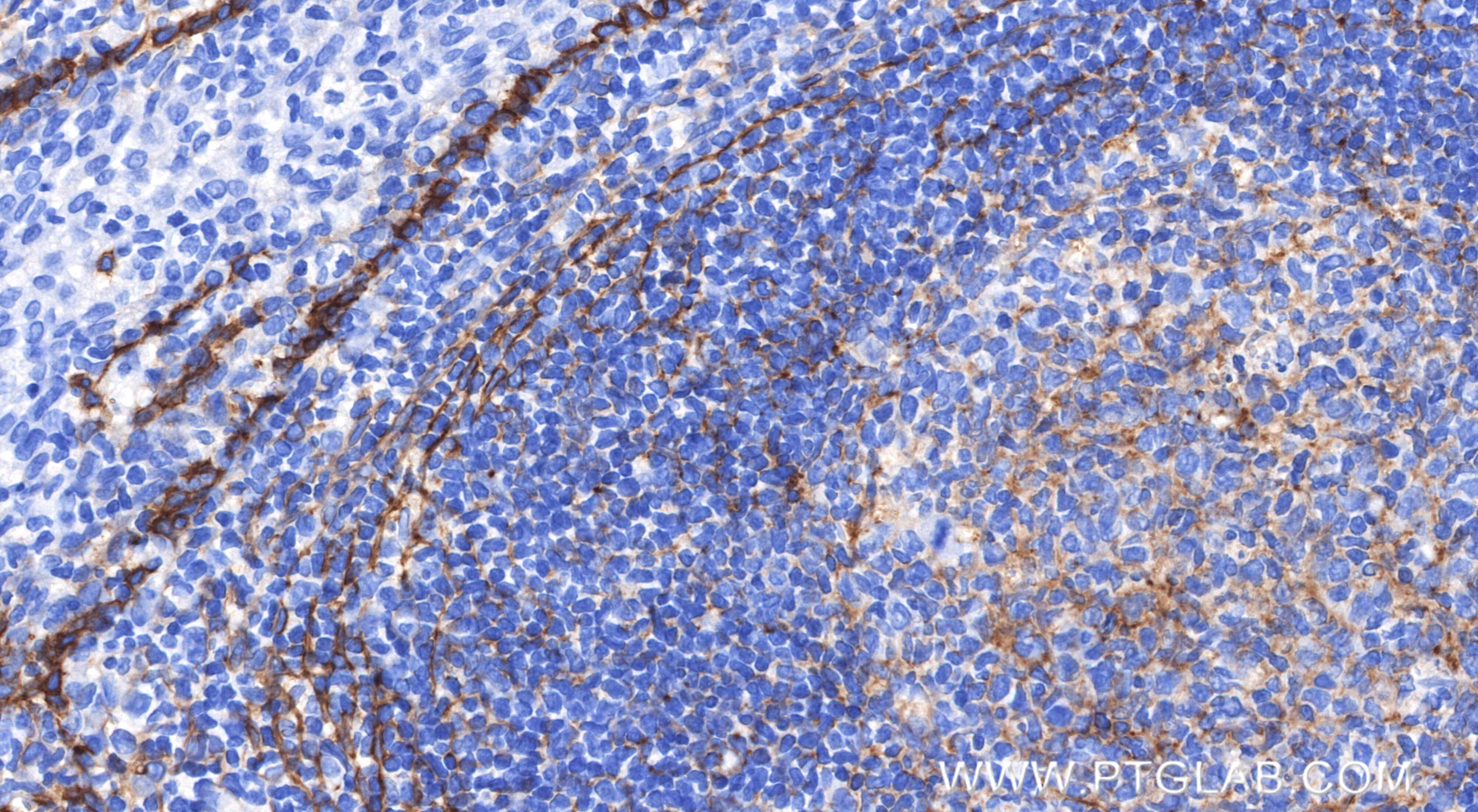 Immunohistochemistry (IHC) staining of human tonsil tissue using Podoplanin Recombinant monoclonal antibody (86750-2-RR)