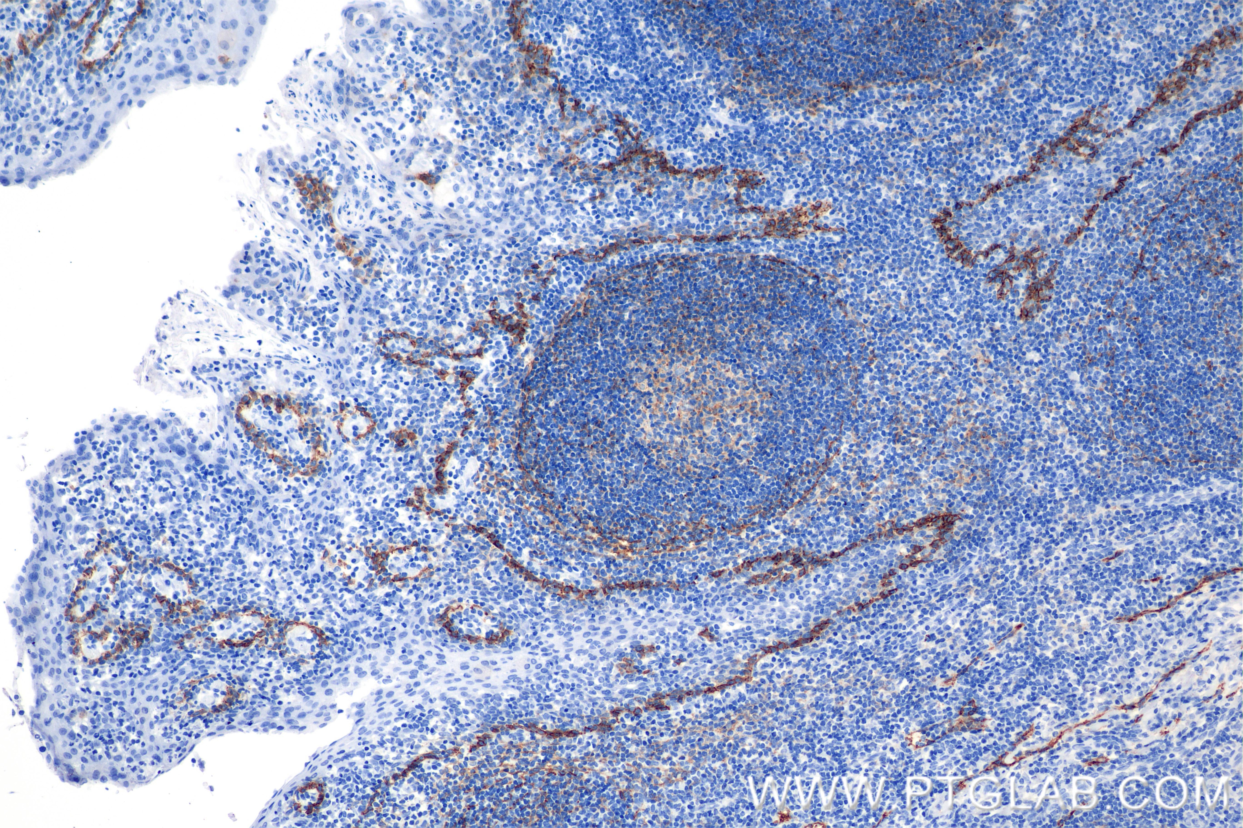 Immunohistochemistry (IHC) staining of human tonsil tissue using Podoplanin Recombinant monoclonal antibody (86750-2-RR)