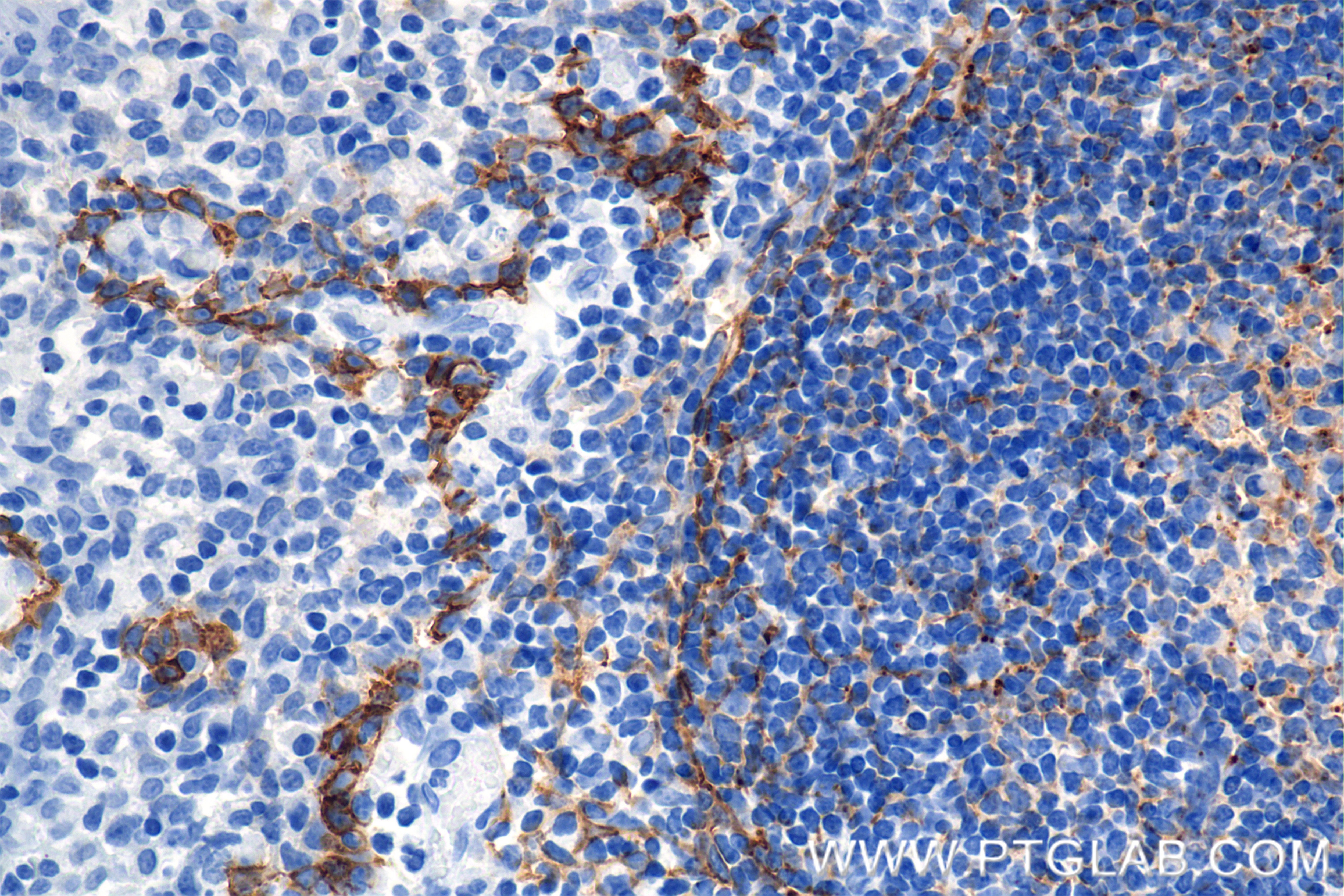 Immunohistochemistry (IHC) staining of human tonsil tissue using Podoplanin Recombinant monoclonal antibody (86750-2-RR)