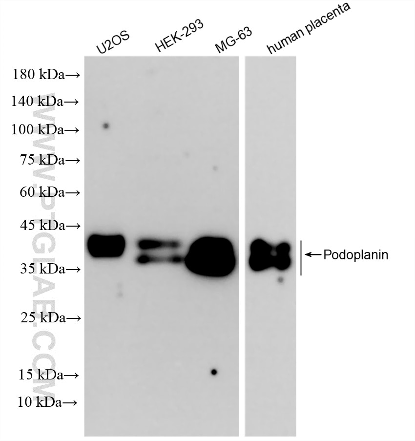 Western Blot (WB) analysis of various lysates using Podoplanin Recombinant monoclonal antibody (86750-2-RR)