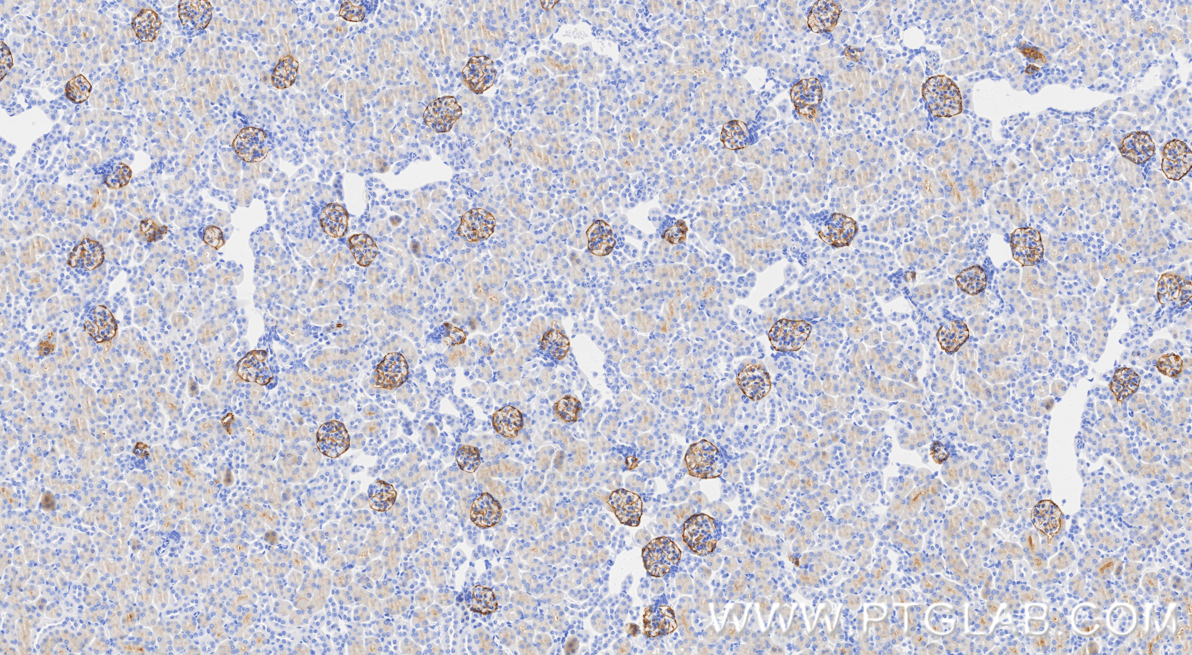 IHC staining of mouse kidney using 98492-3-RR (same clone as 98492-3-PBS) Immunohistochemistry (IHC) staining of mouse kidney tissue using Anti-Mouse Podoplanin Rabbit Recombinant Antibody (98492-3-RR)
