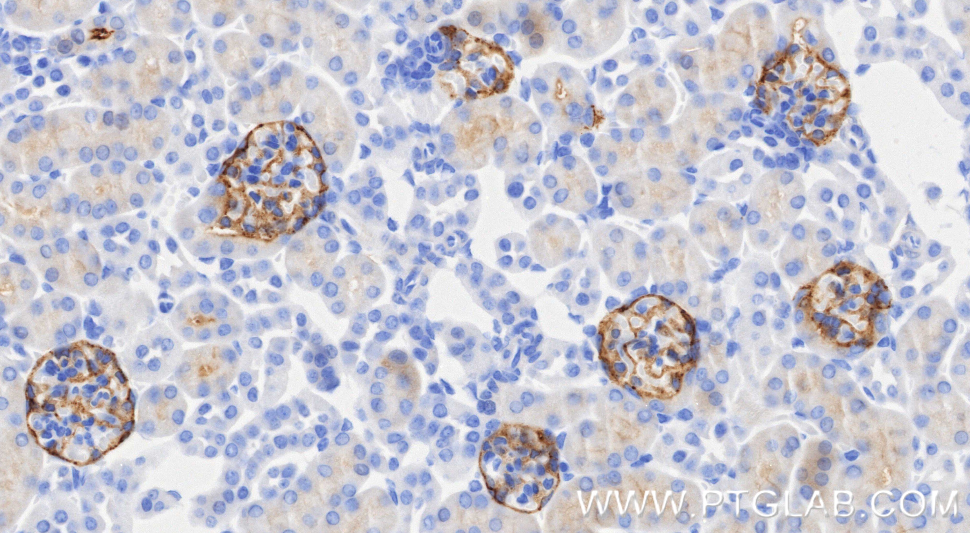 IHC staining of mouse kidney using 98492-3-RR (same clone as 98492-3-PBS) Immunohistochemistry (IHC) staining of mouse kidney tissue using Anti-Mouse Podoplanin Rabbit Recombinant Antibody (98492-3-RR)