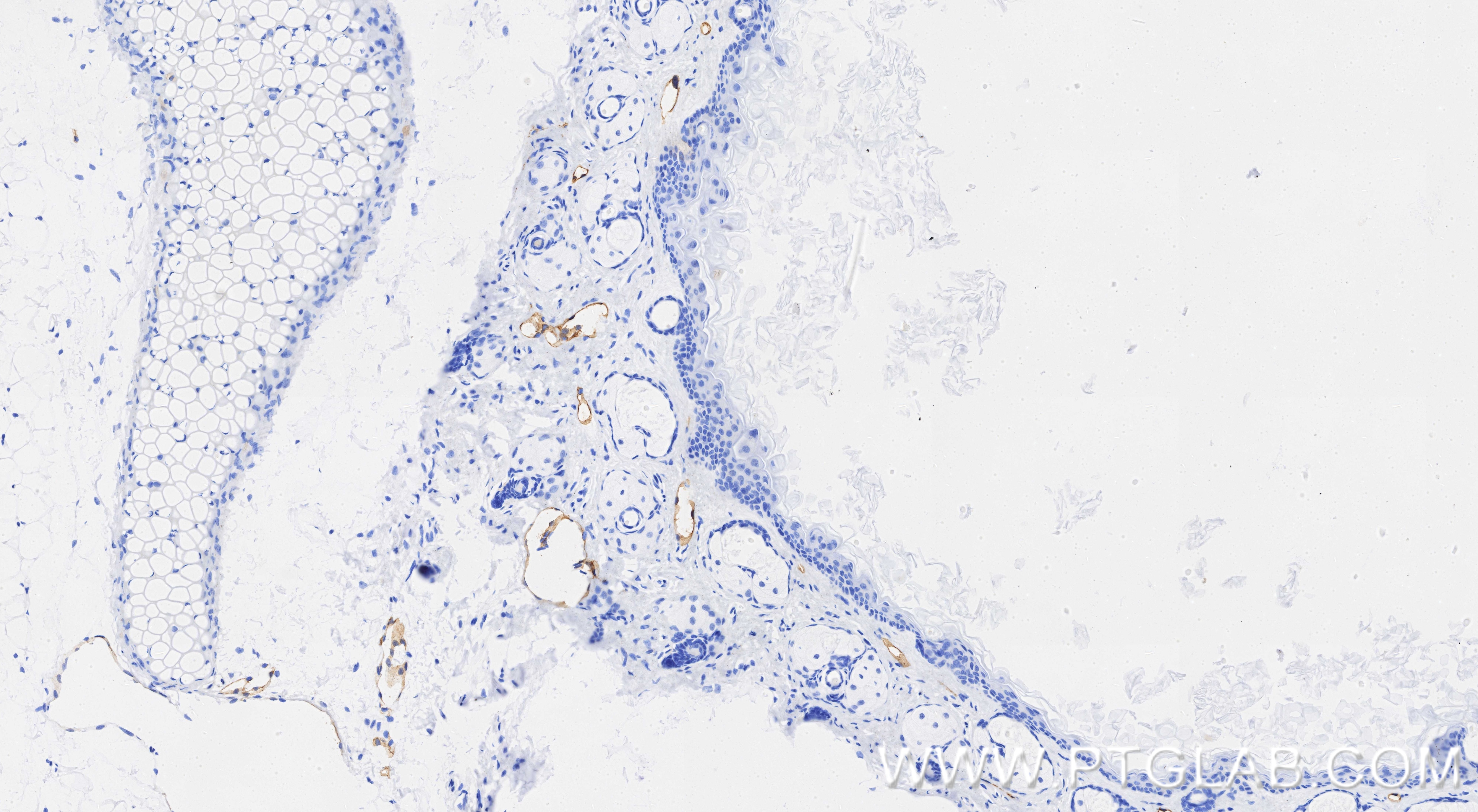IHC staining of mouse skin using 98492-3-RR (same clone as 98492-3-PBS) Immunohistochemistry (IHC) staining of mouse skin tissue using Anti-Mouse Podoplanin Rabbit Recombinant Antibody (98492-3-RR)