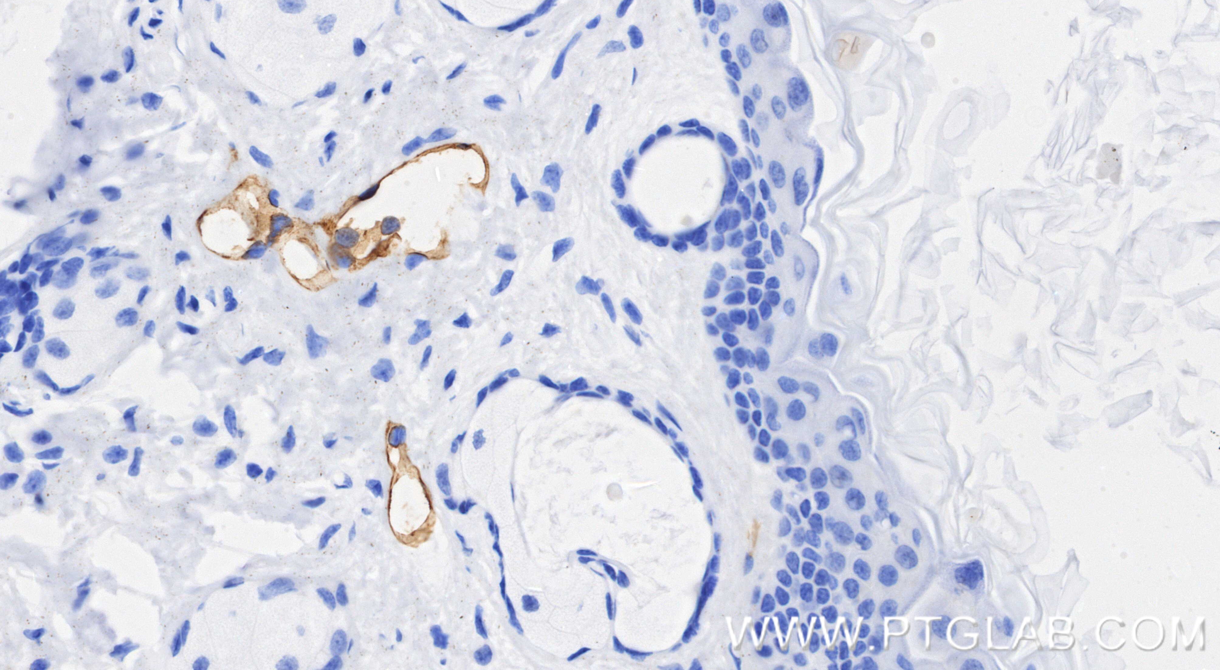 IHC staining of mouse skin using 98492-3-RR (same clone as 98492-3-PBS) Immunohistochemistry (IHC) staining of mouse skin tissue using Anti-Mouse Podoplanin Rabbit Recombinant Antibody (98492-3-RR)