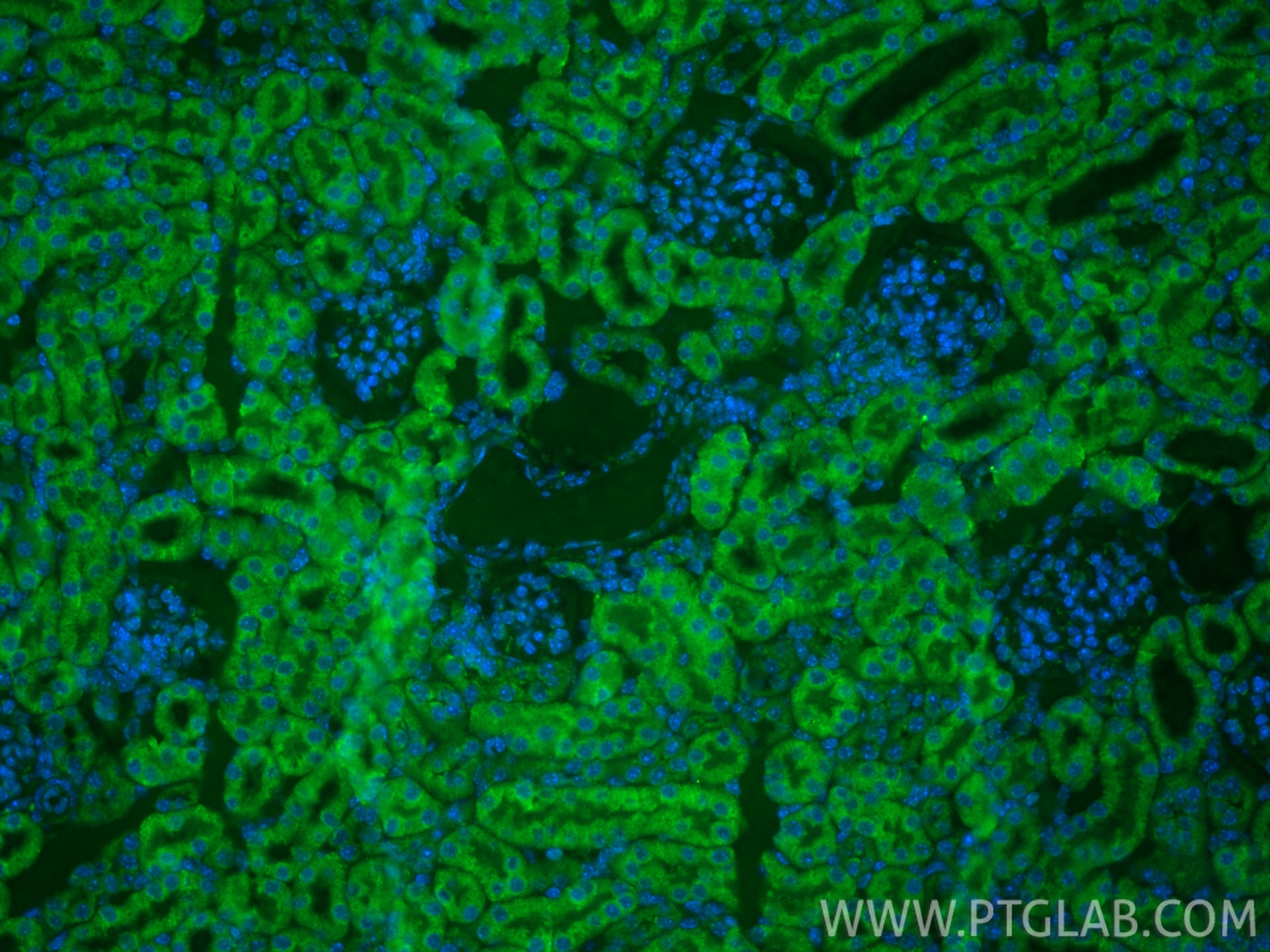 Immunofluorescence (IF) / fluorescent staining of mouse kidney tissue using CoraLite® Plus 488-conjugated Podoplanin Recombina (CL488-86750-2)