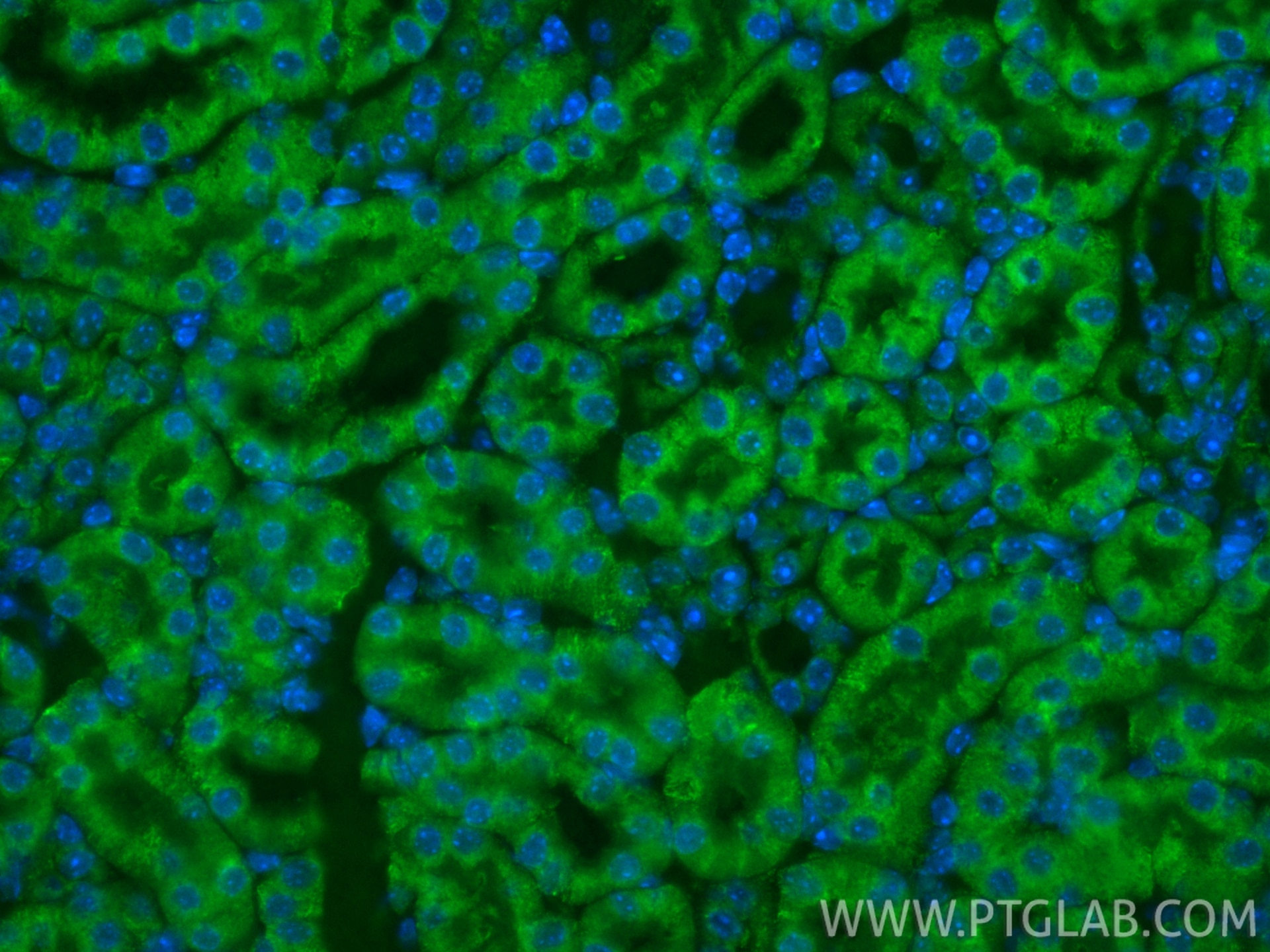 IF Staining of mouse kidney using CL488-86750-2 Immunofluorescence (IF) / fluorescent staining of mouse kidney tissue using CoraLite® Plus 488-conjugated Podoplanin Recombina (CL488-86750-2)