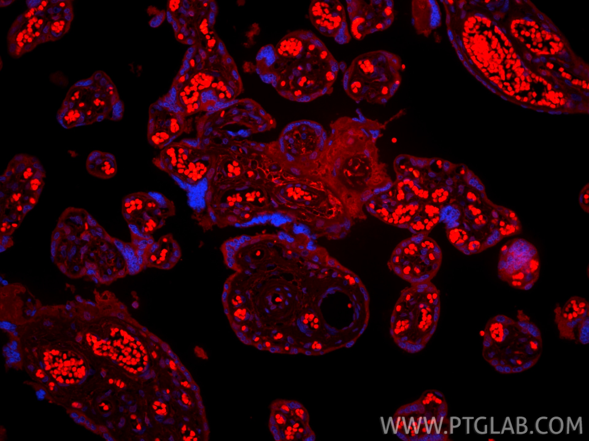 Immunofluorescence (IF) / fluorescent staining of human placenta tissue using CoraLite® Plus 594-conjugated Podoplanin Recombina (CL594-86750-2)