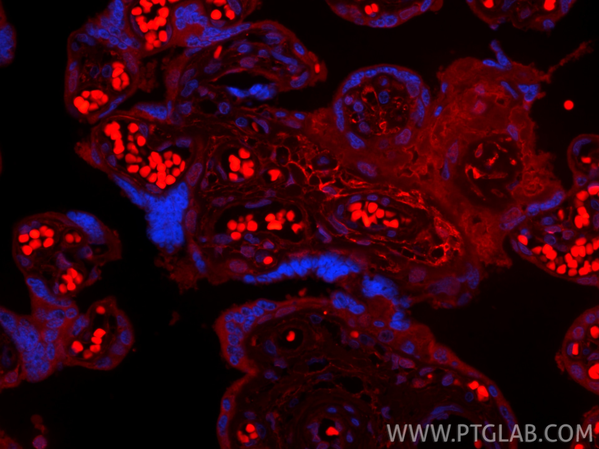 Immunofluorescence (IF) / fluorescent staining of human placenta tissue using CoraLite® Plus 594-conjugated Podoplanin Recombina (CL594-86750-2)