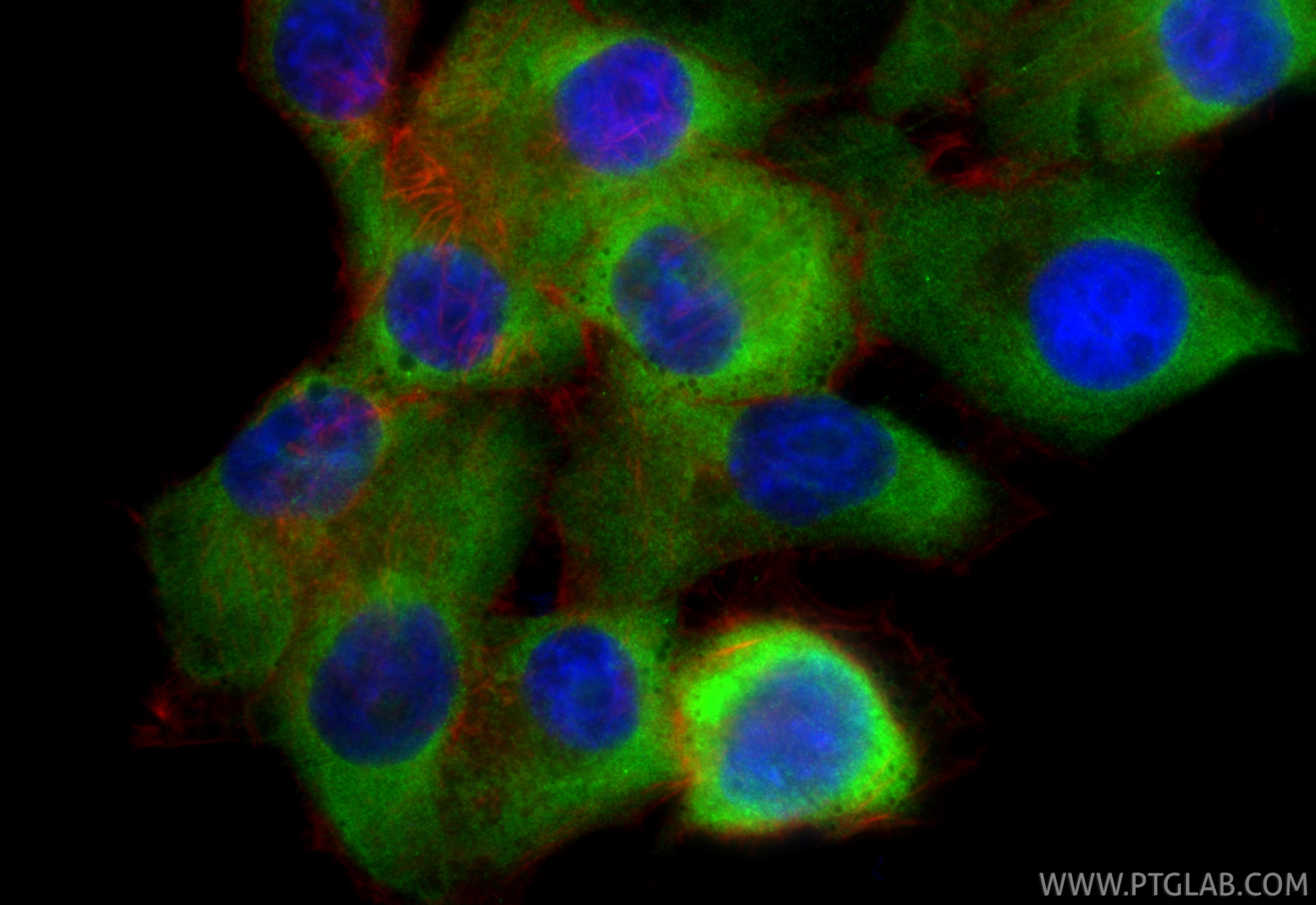 IF Staining of PANC-1 using 22263-1-AP Immunofluorescence (IF) / fluorescent staining of PANC-1 cells using Polycystin 1 Polyclonal antibody (22263-1-AP)