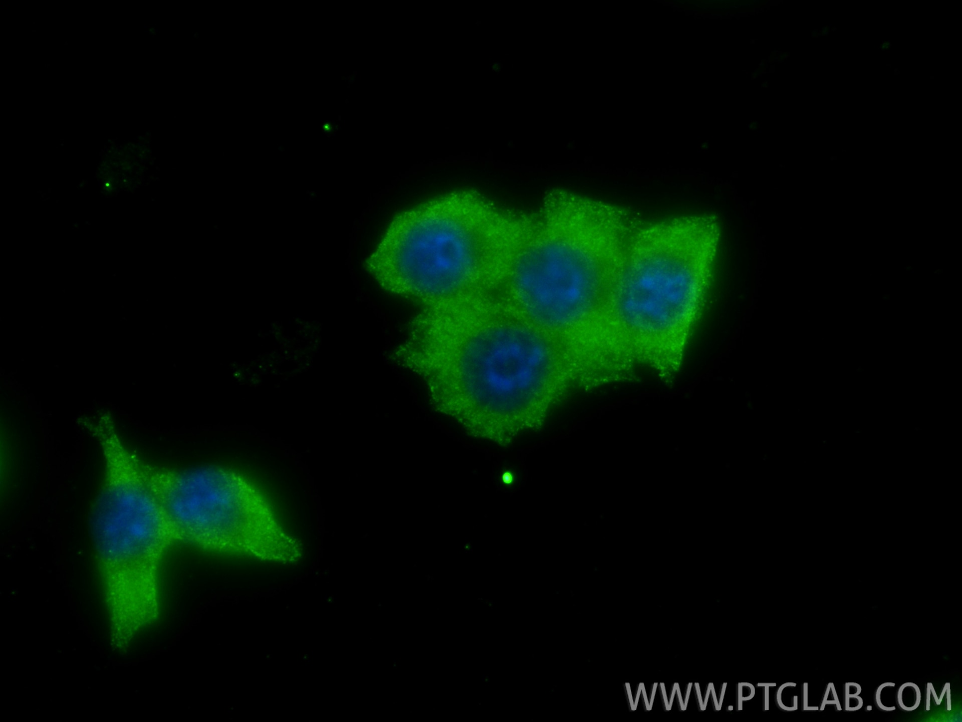 IF Staining of 4T1 using 22263-1-AP Immunofluorescence (IF) / fluorescent staining of 4T1 cells using Polycystin 1 Polyclonal antibody (22263-1-AP)