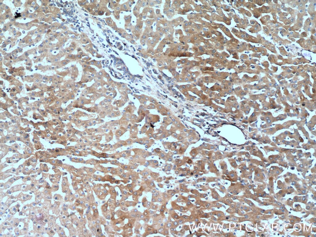 Immunohistochemistry (IHC) staining of human liver tissue using Polycystin 1 Polyclonal antibody (22263-1-AP)