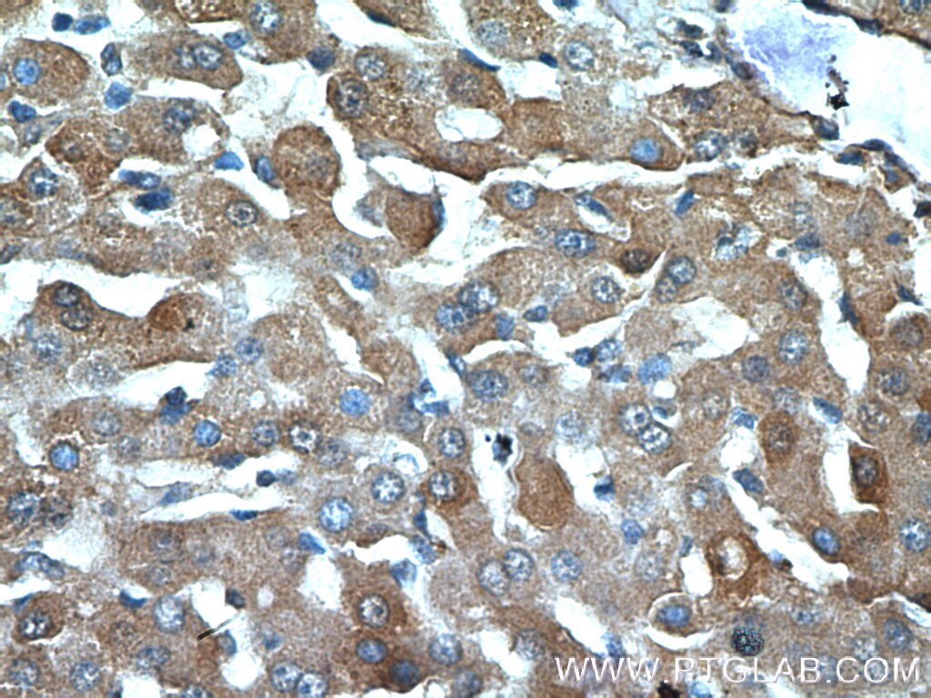 Immunohistochemistry (IHC) staining of human liver tissue using Polycystin 1 Polyclonal antibody (22263-1-AP)