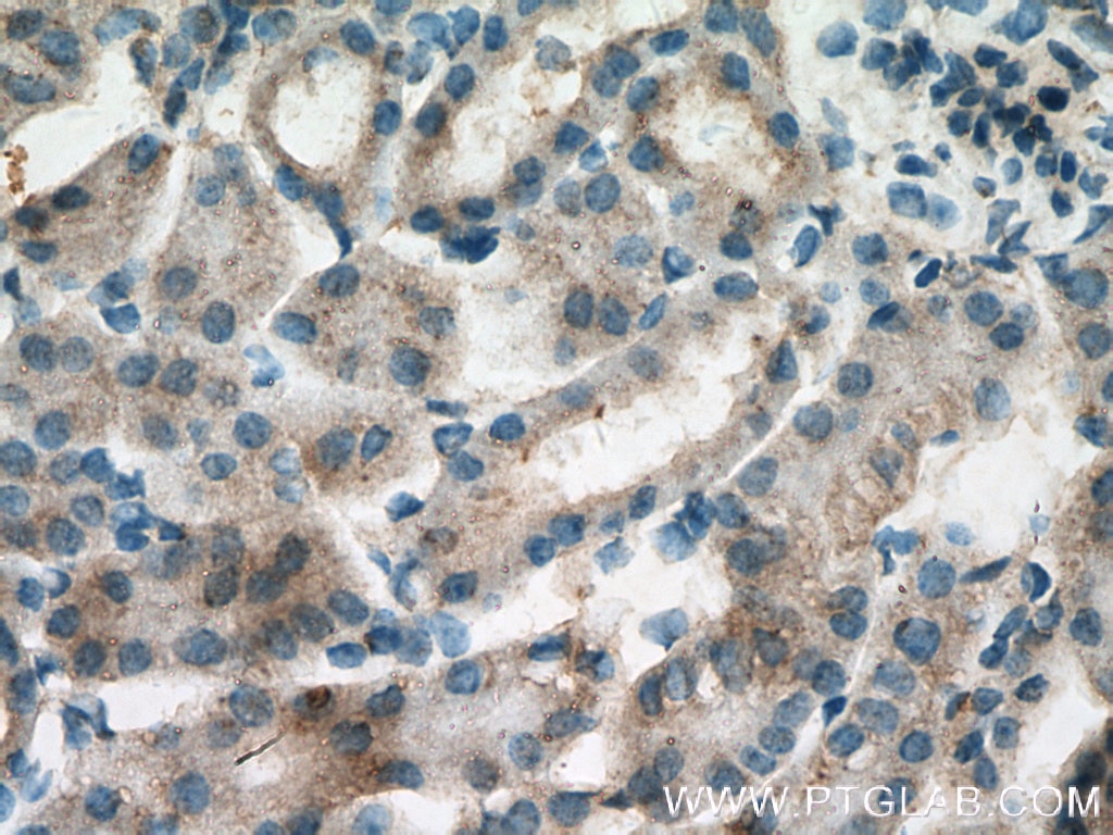 Immunohistochemistry (IHC) staining of mouse kidney tissue using Polycystin 1 Polyclonal antibody (22263-1-AP)