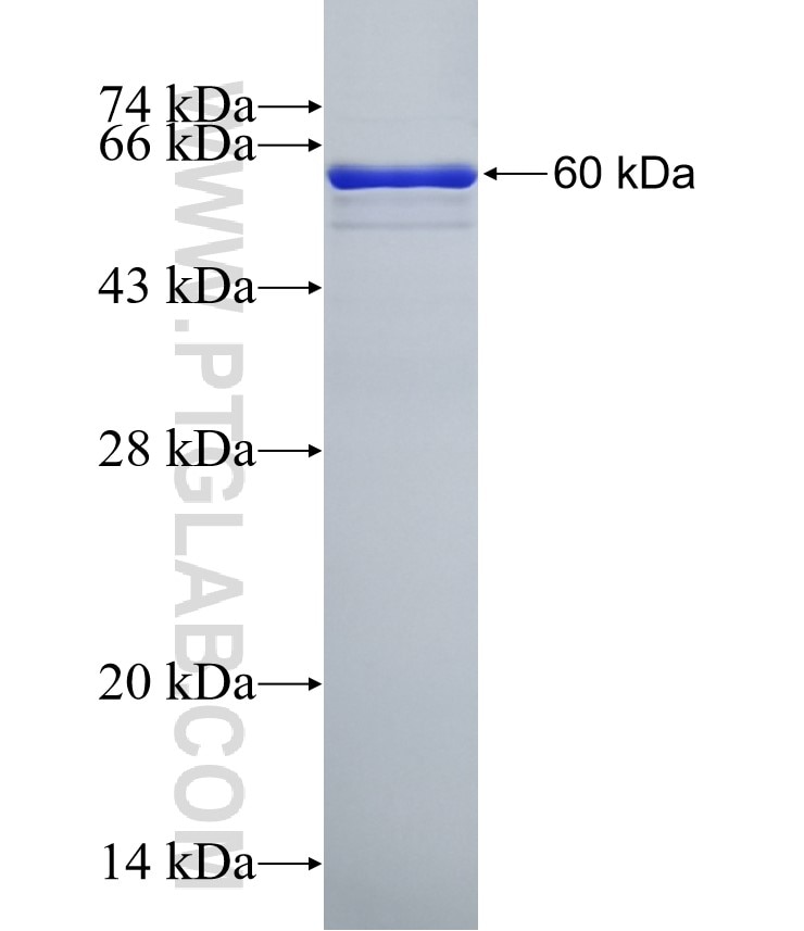 Porin fusion protein Ag1144 SDS-PAGE