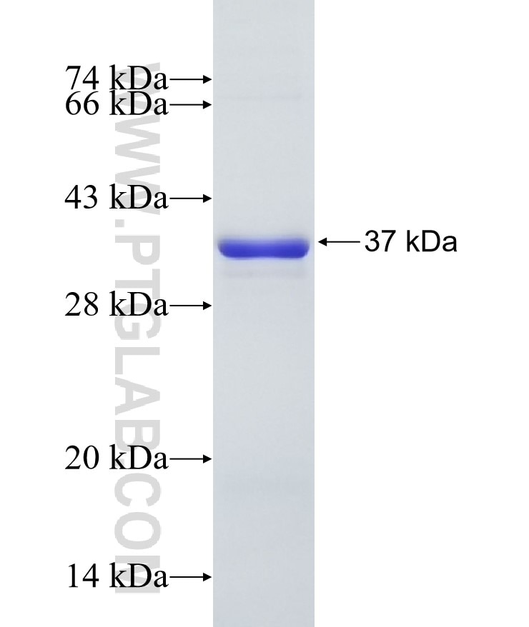 Porin fusion protein Ag9241 SDS-PAGE