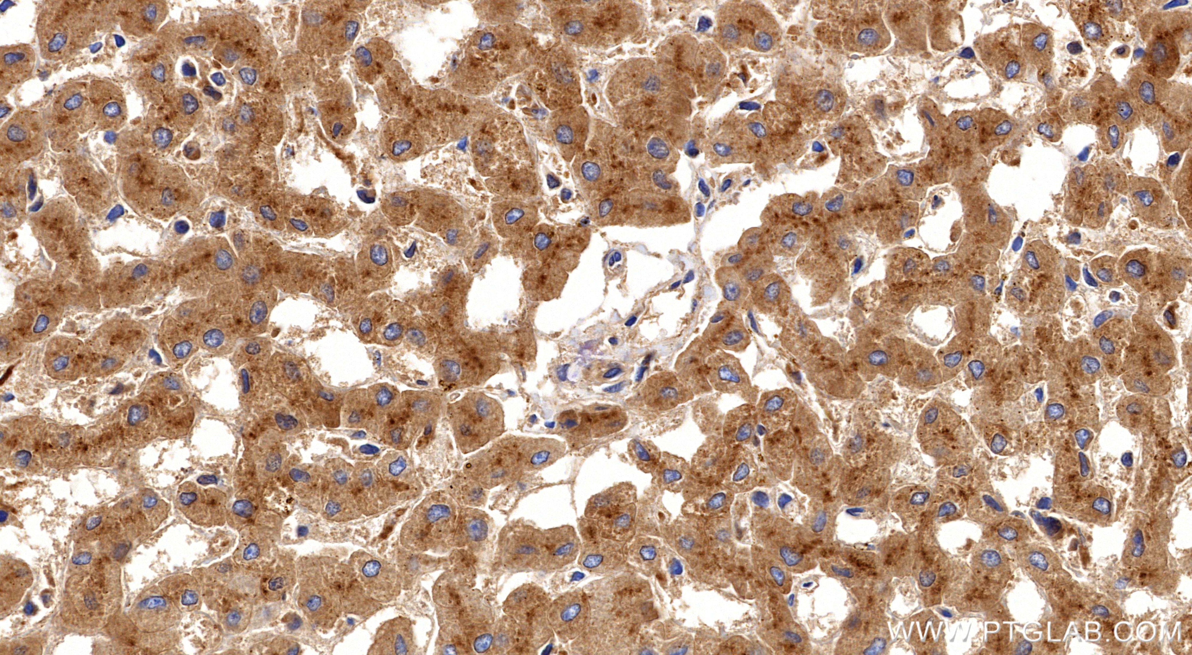 Immunohistochemistry (IHC) staining of human liver tissue using Prealbumin/transthyretin Recombinant monoclonal an (86273-1-RR)