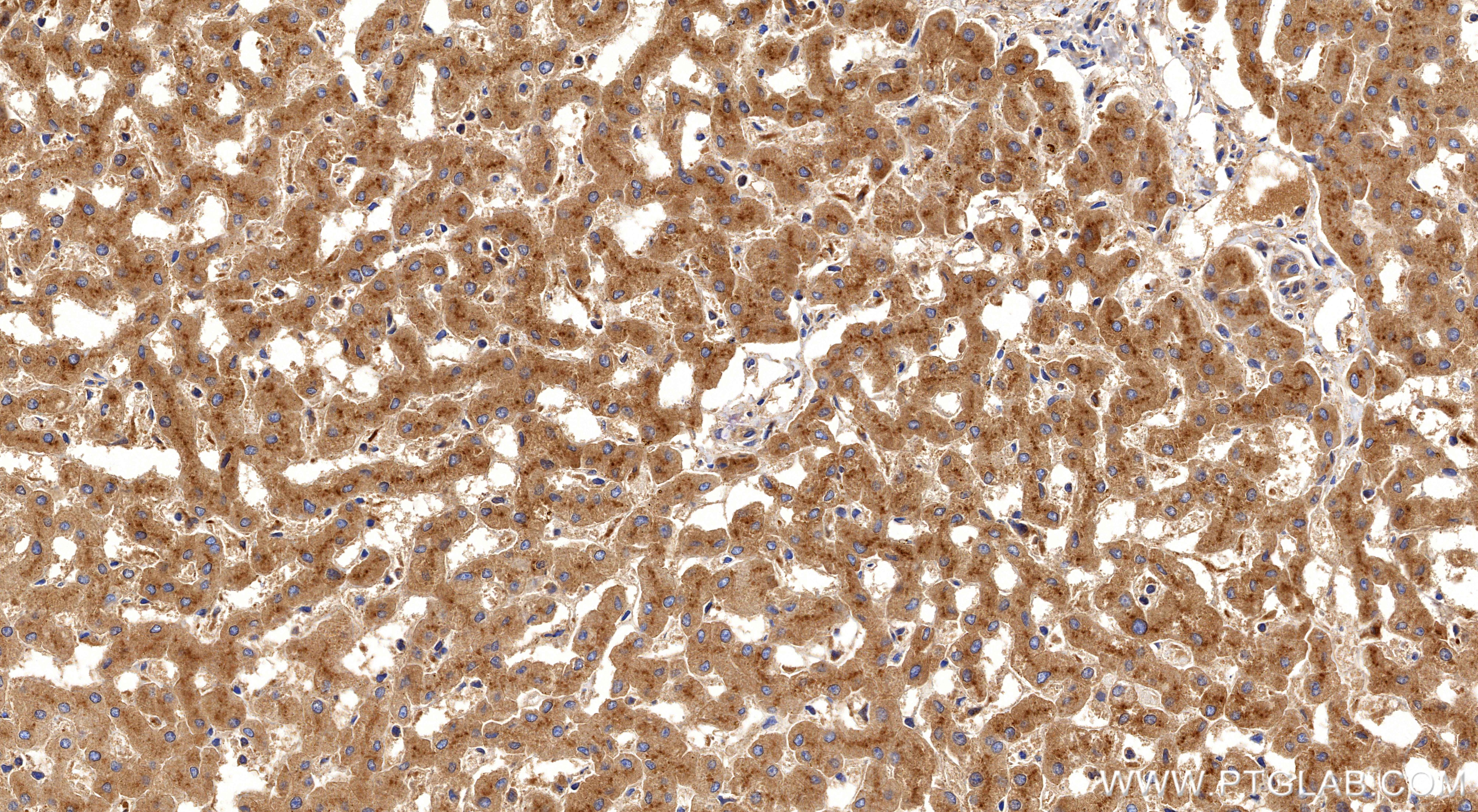 Immunohistochemistry (IHC) staining of human liver tissue using Prealbumin/transthyretin Recombinant monoclonal an (86273-1-RR)