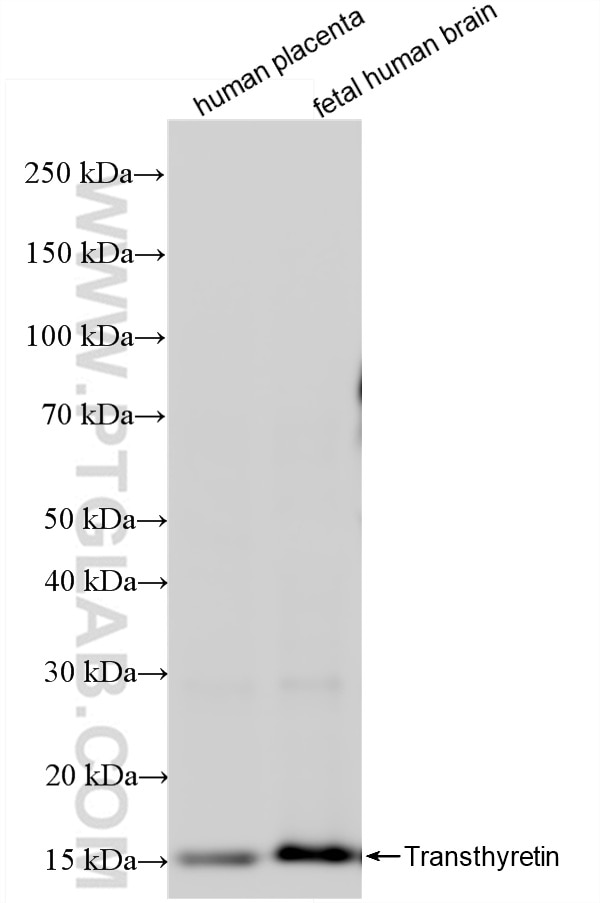 Western Blot (WB) analysis of various lysates using Prealbumin/transthyretin Recombinant antibody (86273-1-RR)