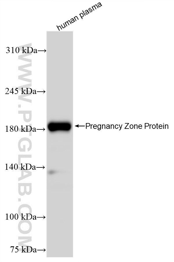 Western Blot (WB) analysis of human plasma using Pregnancy Zone Protein Recombinant antibody (84605-4-RR)