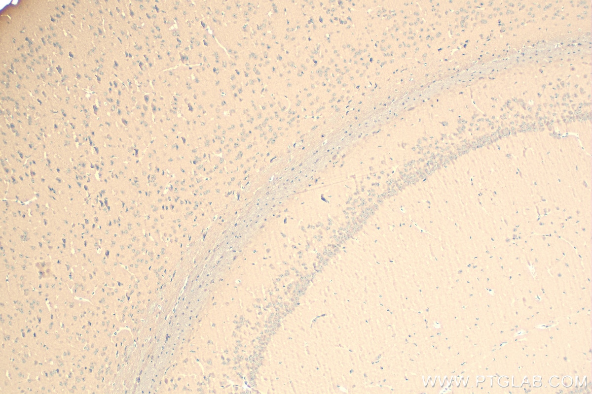 Immunohistochemistry (IHC) staining of mouse brain tissue using Presenilin-1-Specific Recombinant antibody (83618-3-RR)