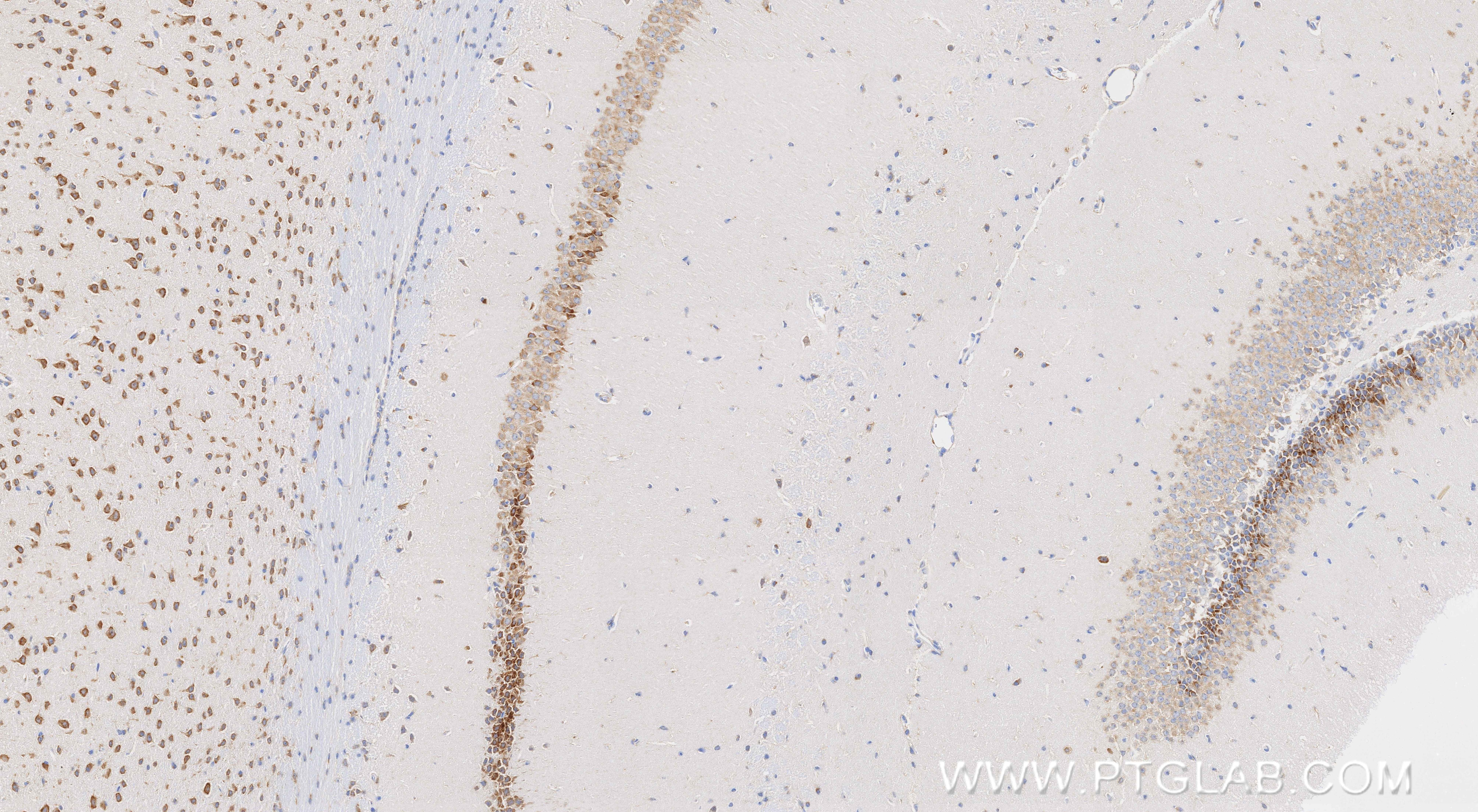 Immunohistochemistry (IHC) staining of mouse brain tissue using Presenilin-1-Specific Recombinant monoclonal antib (83618-5-RR)