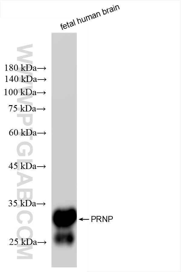 Prion protein PrP