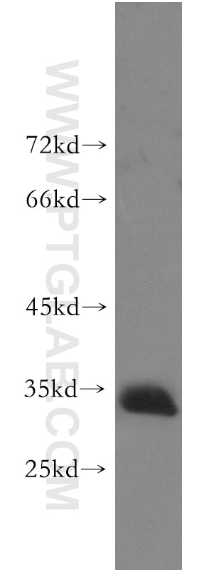 WB analysis of human skeletal muscle using 51026-2-AP