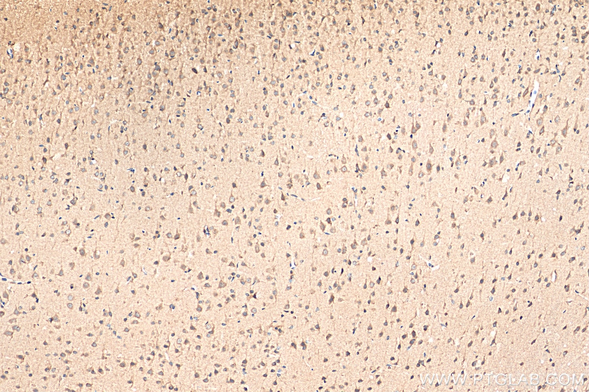 Immunohistochemistry (IHC) staining of rat brain tissue using ProSAPiP1 Polyclonal antibody (24936-1-AP)