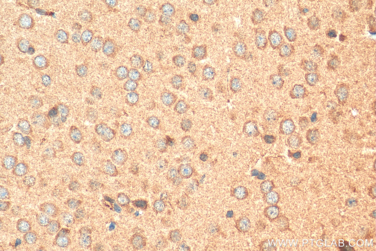 Immunohistochemistry (IHC) staining of mouse brain tissue using ProSAPiP1 Polyclonal antibody (24936-1-AP)