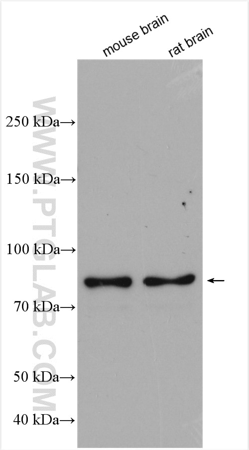 Western Blot (WB) analysis of various lysates using ProSAPiP1 Polyclonal antibody (24936-1-AP)