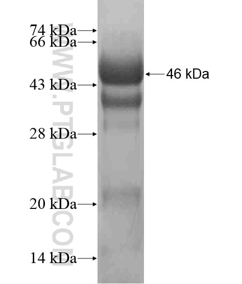 ProSAPiP1 fusion protein Ag20765 SDS-PAGE