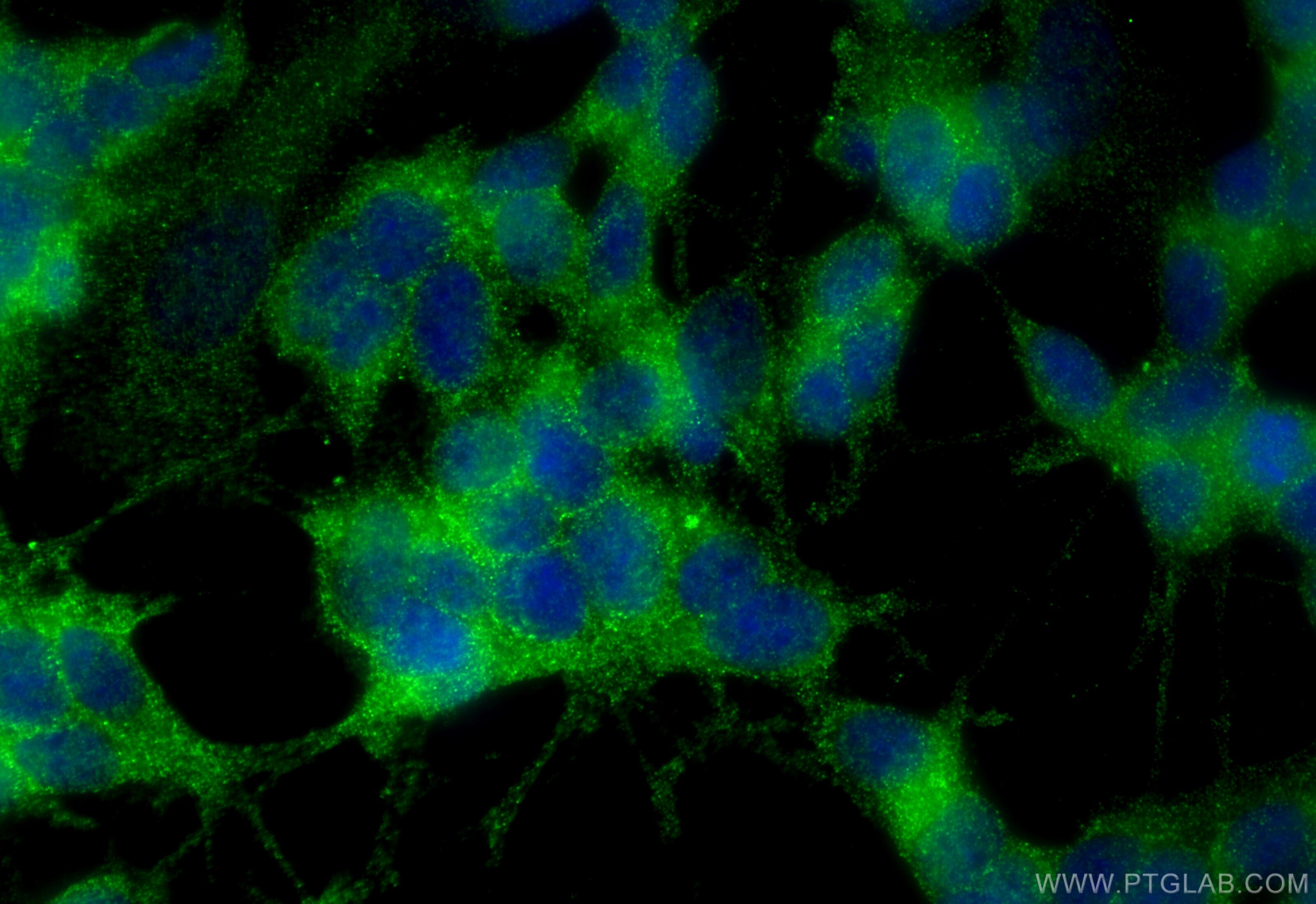 Immunofluorescence (IF) / fluorescent staining of SH-SY5Y cells using Proenkephalin-A Polyclonal antibody (32272-1-AP)