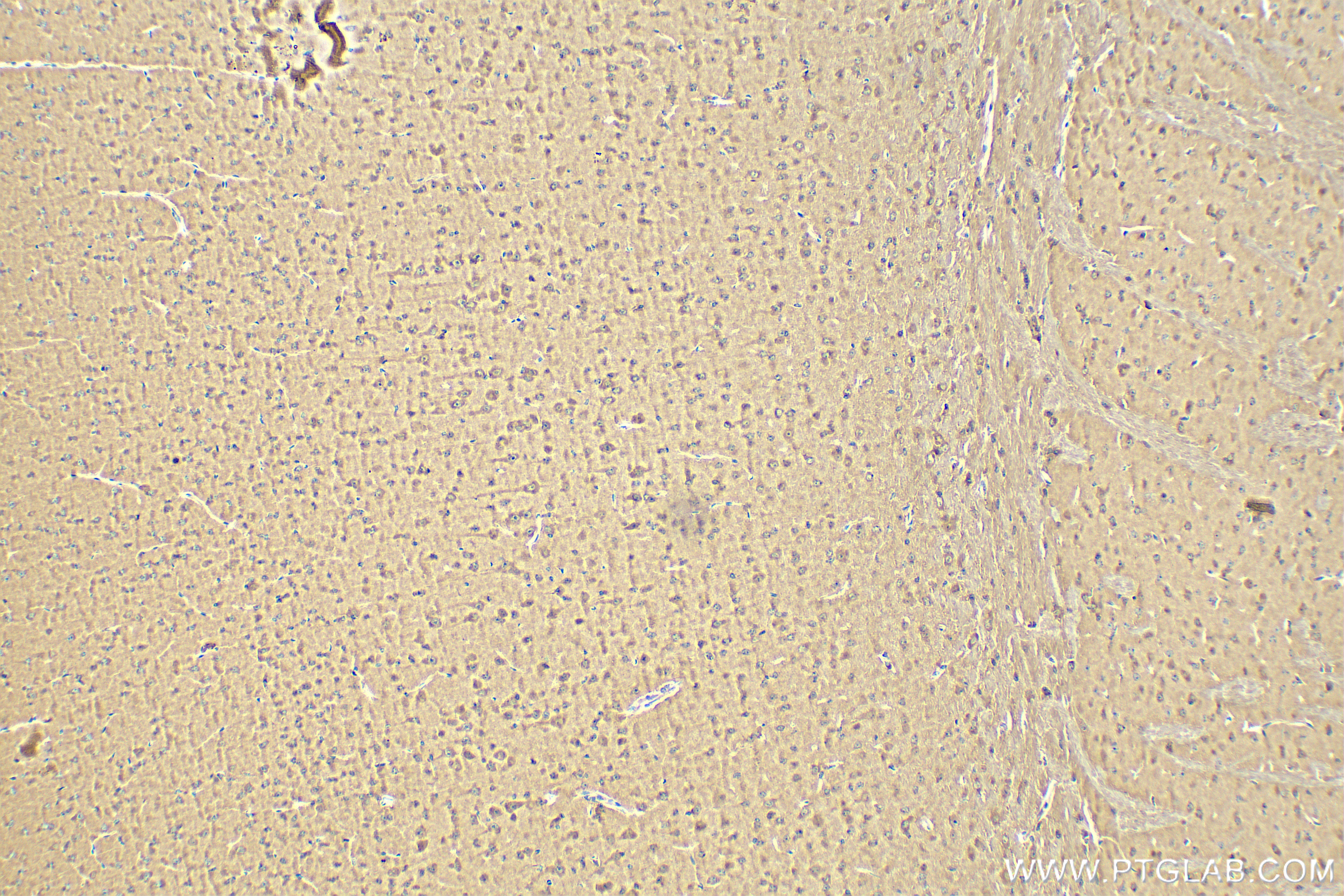 Immunohistochemistry (IHC) staining of mouse brain tissue using Proenkephalin-A Polyclonal antibody (32272-1-AP)
