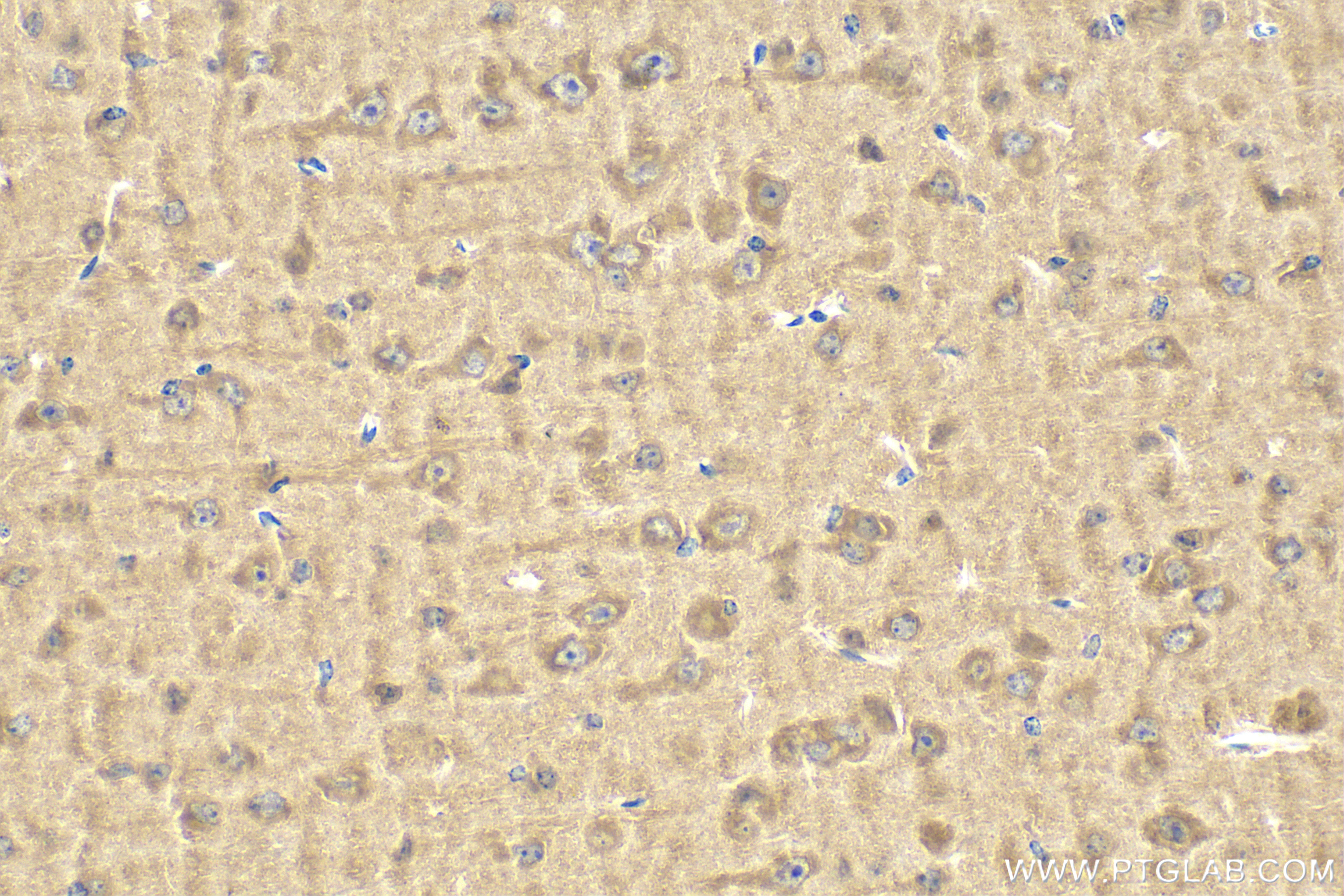 Immunohistochemistry (IHC) staining of mouse brain tissue using Proenkephalin-A Polyclonal antibody (32272-1-AP)